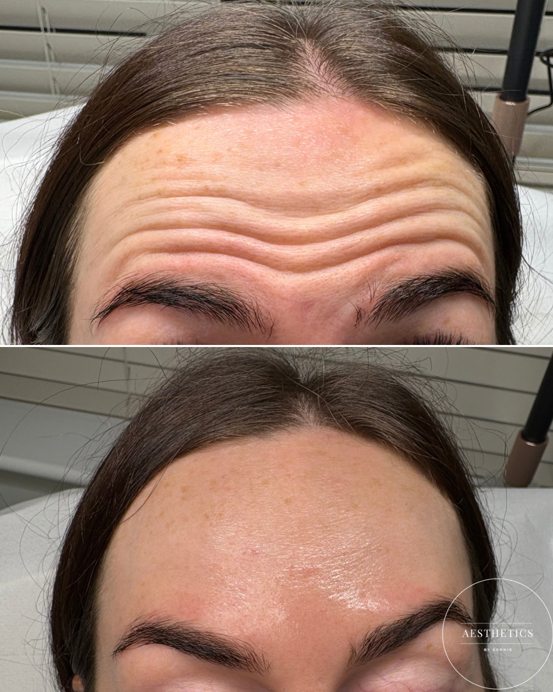 Beth before & after.PNG