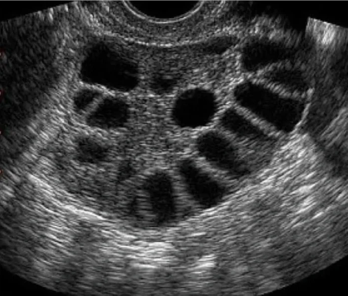 pelvic ultrasound, ultrasound of the uterus and ovaries in orange county, RadiantView Wellness Ultrasound