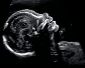 2d ultrasound at radiantview ultrasound