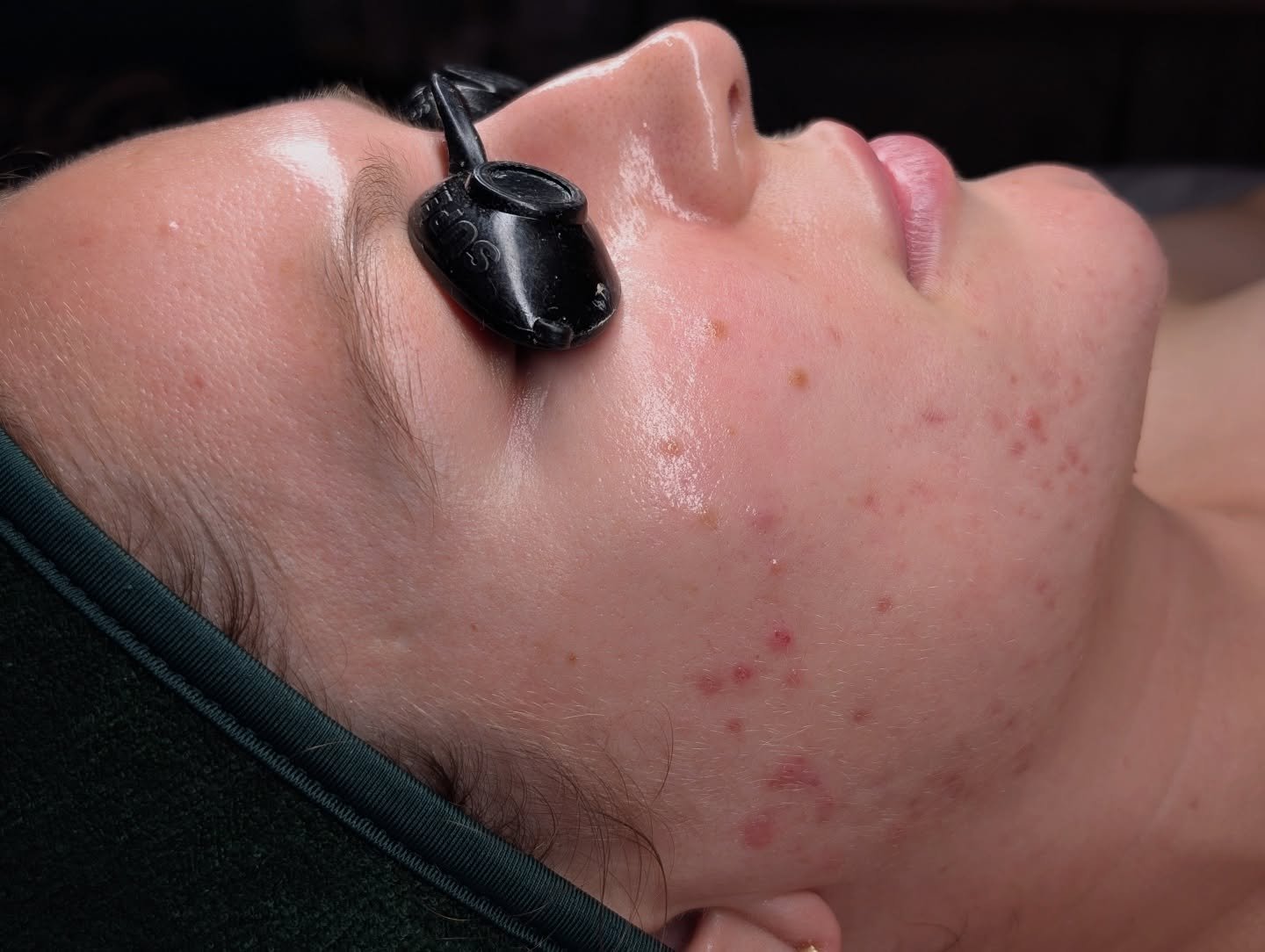 What a difference one month can make!!!
I&rsquo;m really proud of this one, figuring out what a client needs is different each time
After all these years I can confidently say there are very few cases that I consider challenging ☺️🤓

Let me know if 