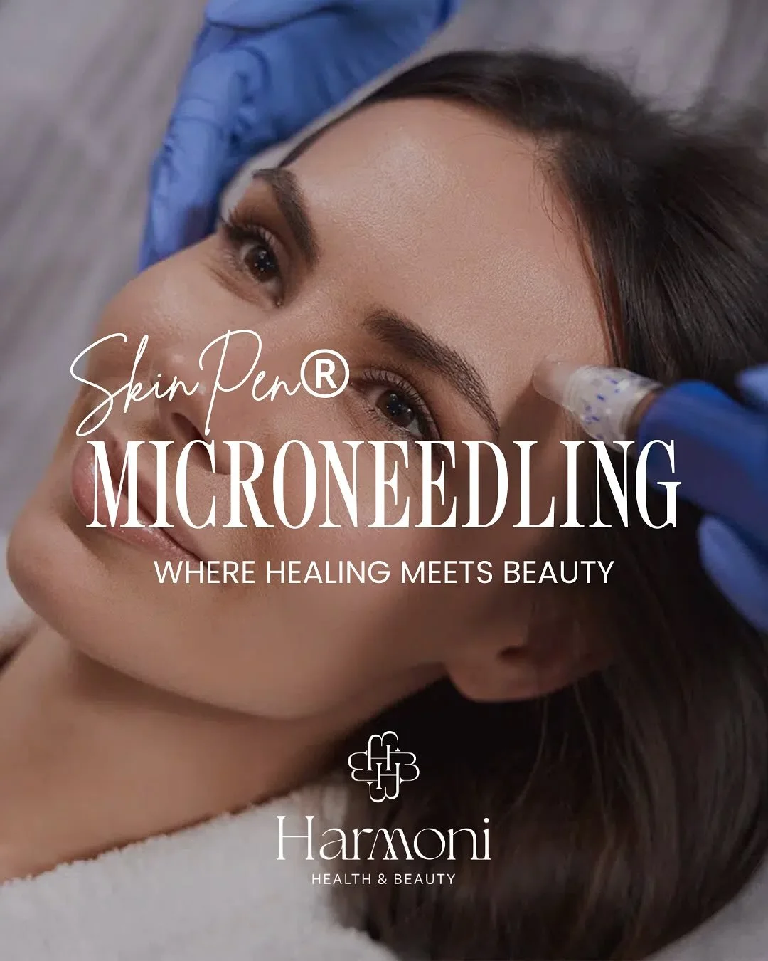 ✨ Curious about microneedling? ✨
Swipe through to learn how this treatment naturally stimulates your skin&rsquo;s own healing power for smoother texture, brighter tone, and long-term results.

🌿 Safe &bull; Effective &bull; Backed by science

Ready 