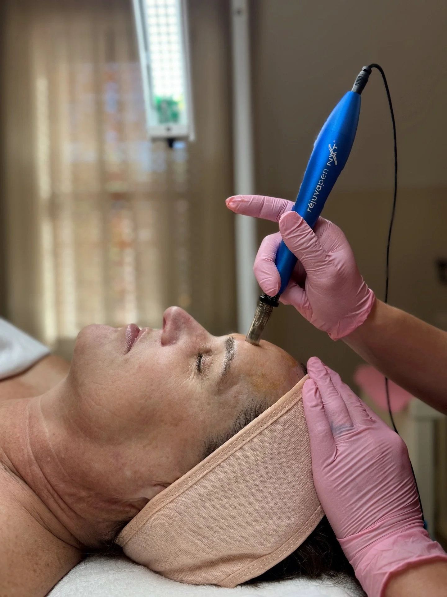 It&rsquo;s Microneedling SZN and we are here for it!

💡 Did you know that one microneedling session can stimulate up to 200&ndash;400% more collagen production over time. Your skin keeps building new collagen for months after your treatment &mdash; 