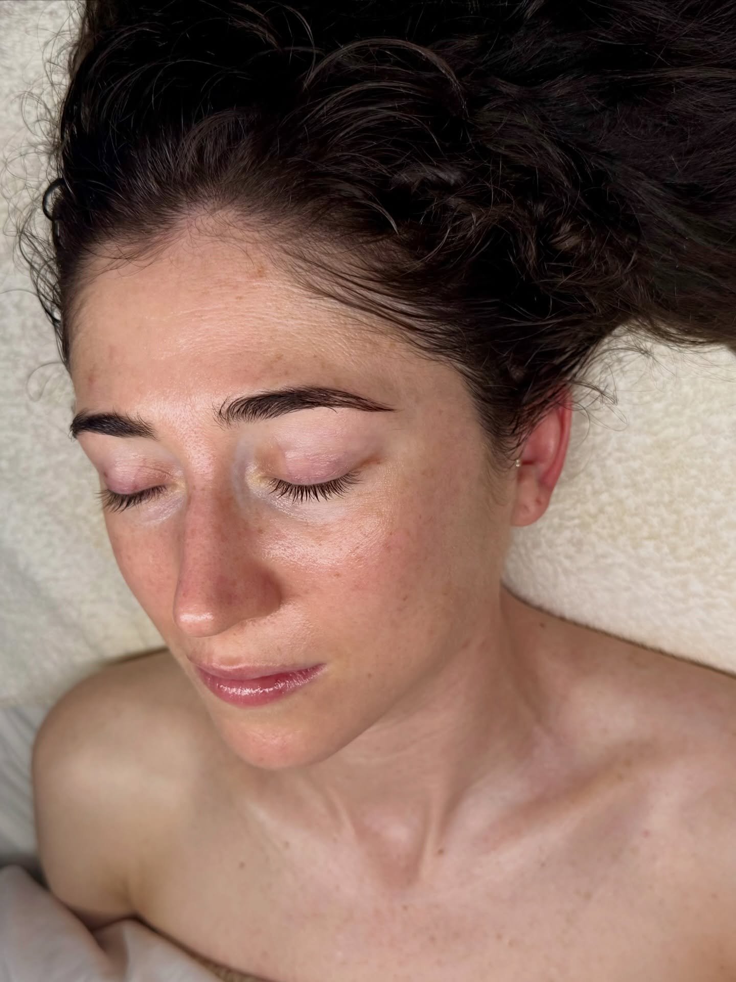 We have been seeing this beauty for 3+ years now. She has gone from chronically dry skin with pesky breakouts, to hydrated and supple skin with almost no breakouts ever. She is consistent with her monthly appointments as well as her home care&hellip;