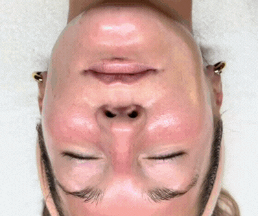 A woman is receiving a facial treatment from an esthetician in a spa. The woman has her eyes closed and is lying on a treatment bed, wearing a beige headband. The esthetician, wearing pink gloves, is gently massaging her face.