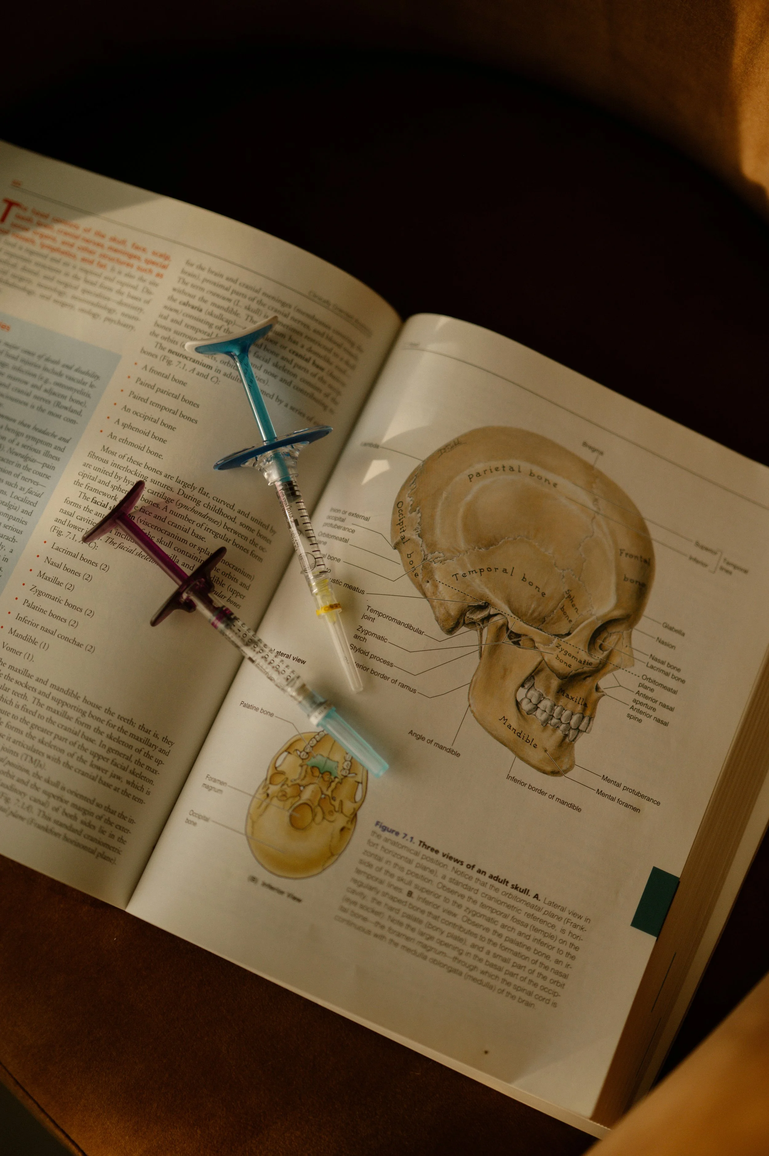 Open anatomy book showing diagram of a human skull with labeled bones, placed on a wooden surface, with two syringes resting on the pages.
