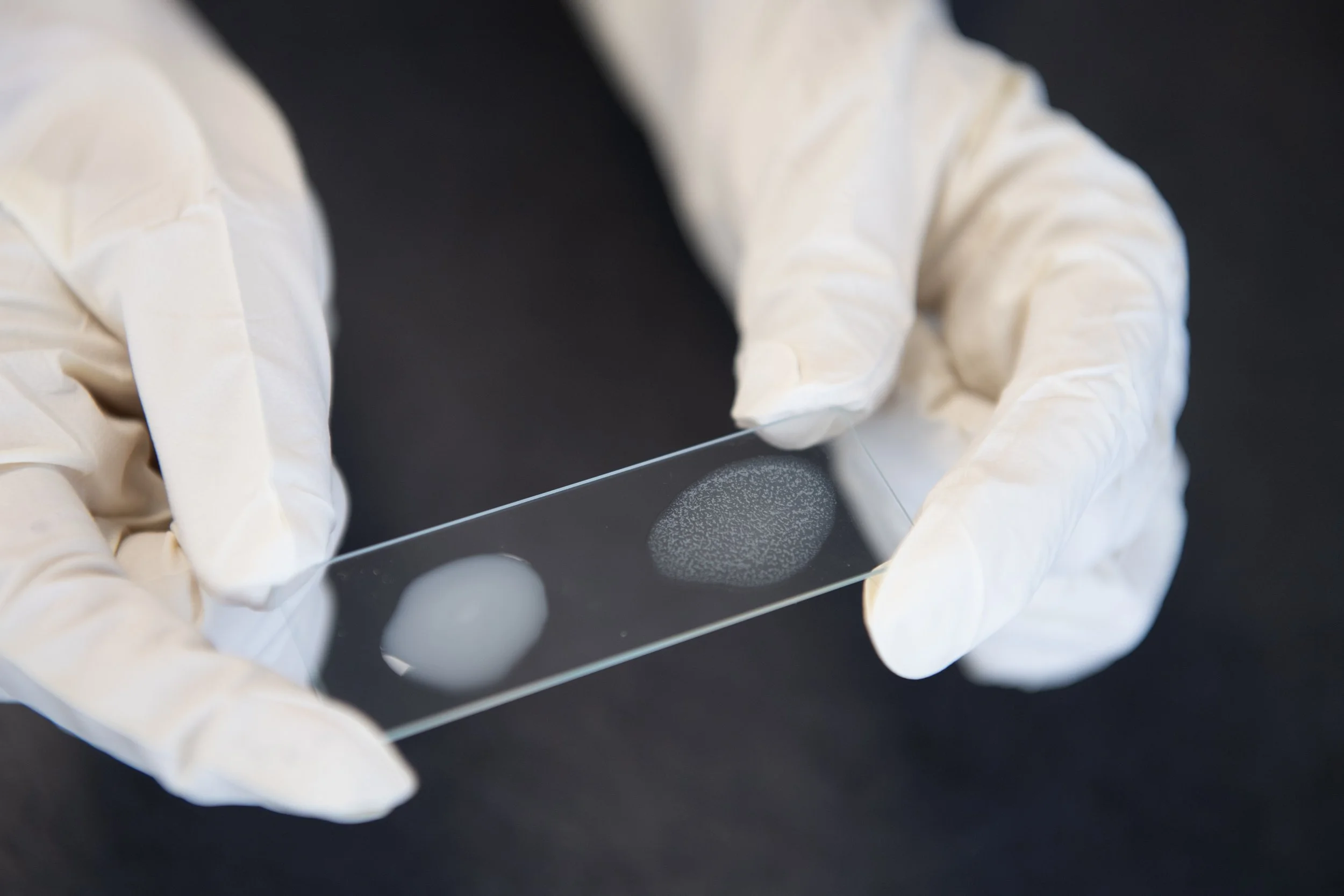 Close-up digital illustration of numerous bacteria with elongated, textured bodies and fine hair-like structures, colored in shades of purple and pink, against a dark background.