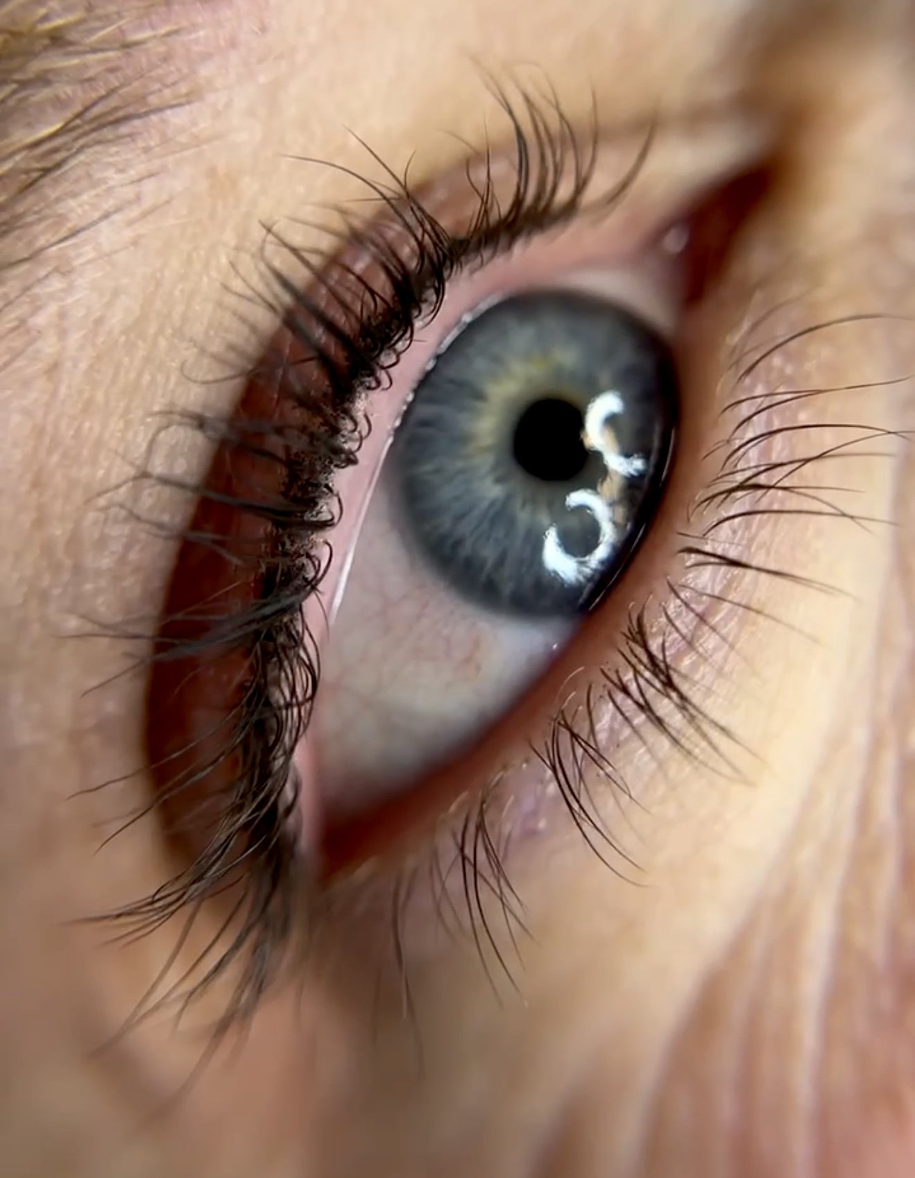 Close-up of a person after receiving Eyeliner Micropigmentation treatment