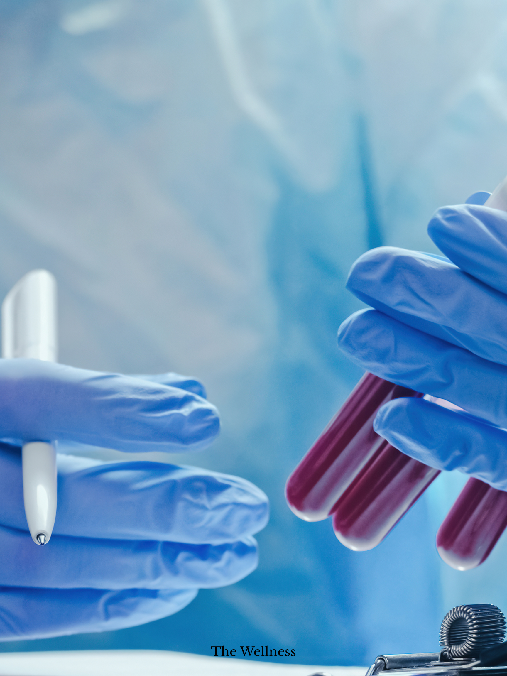 Blood Test Services and Fast Results from Private GPs in London