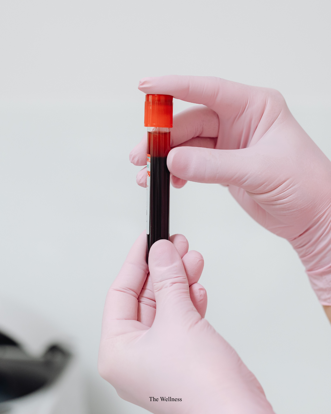 Private Blood Tests in London: The Complete 2026 Guide to Costs, What Is Tested and How to Get Same-Day Results