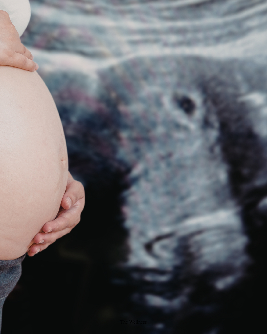 Early Pregnancy Scan in London: Private Dating and Reassurance Scans With Same-Day Results