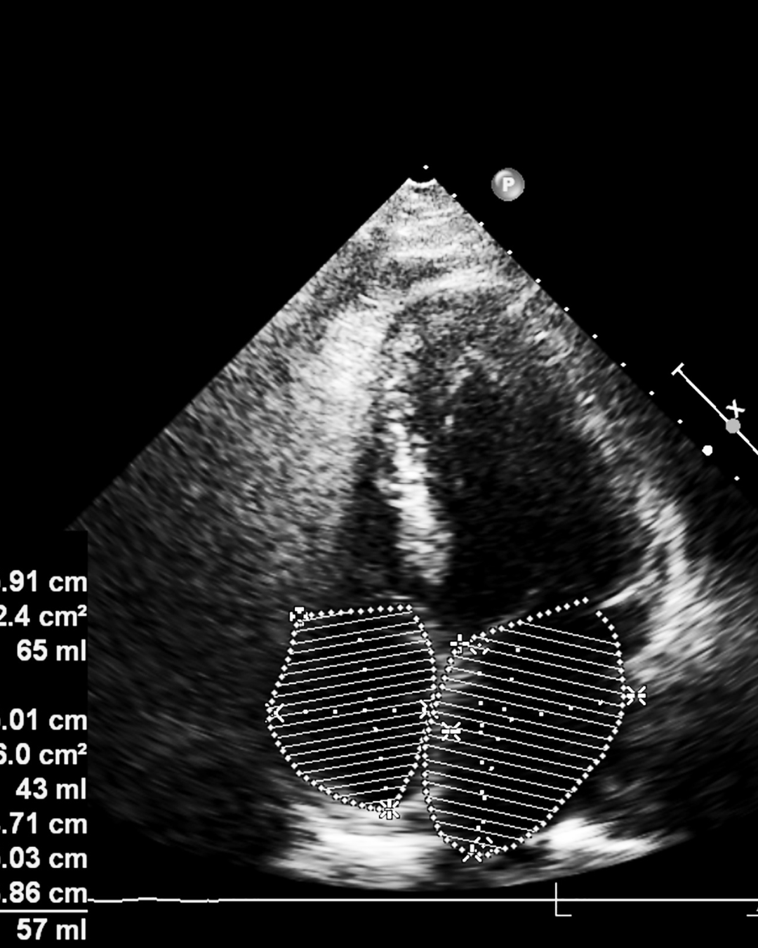 Echocardiogram in London: Private Heart Scan With Same-Day Doctor-Interpreted Results