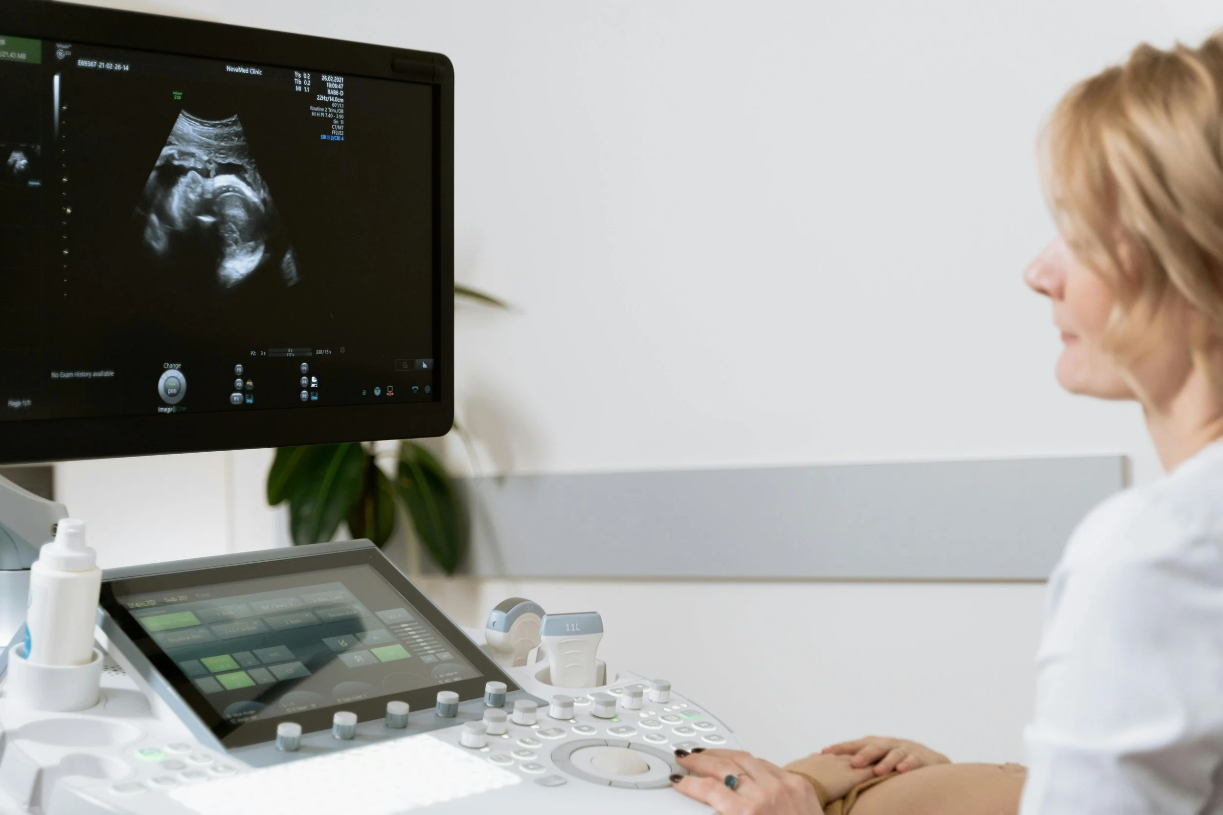 Private Ultrasound London 2026: Doctor-Performed Diagnostic Imaging