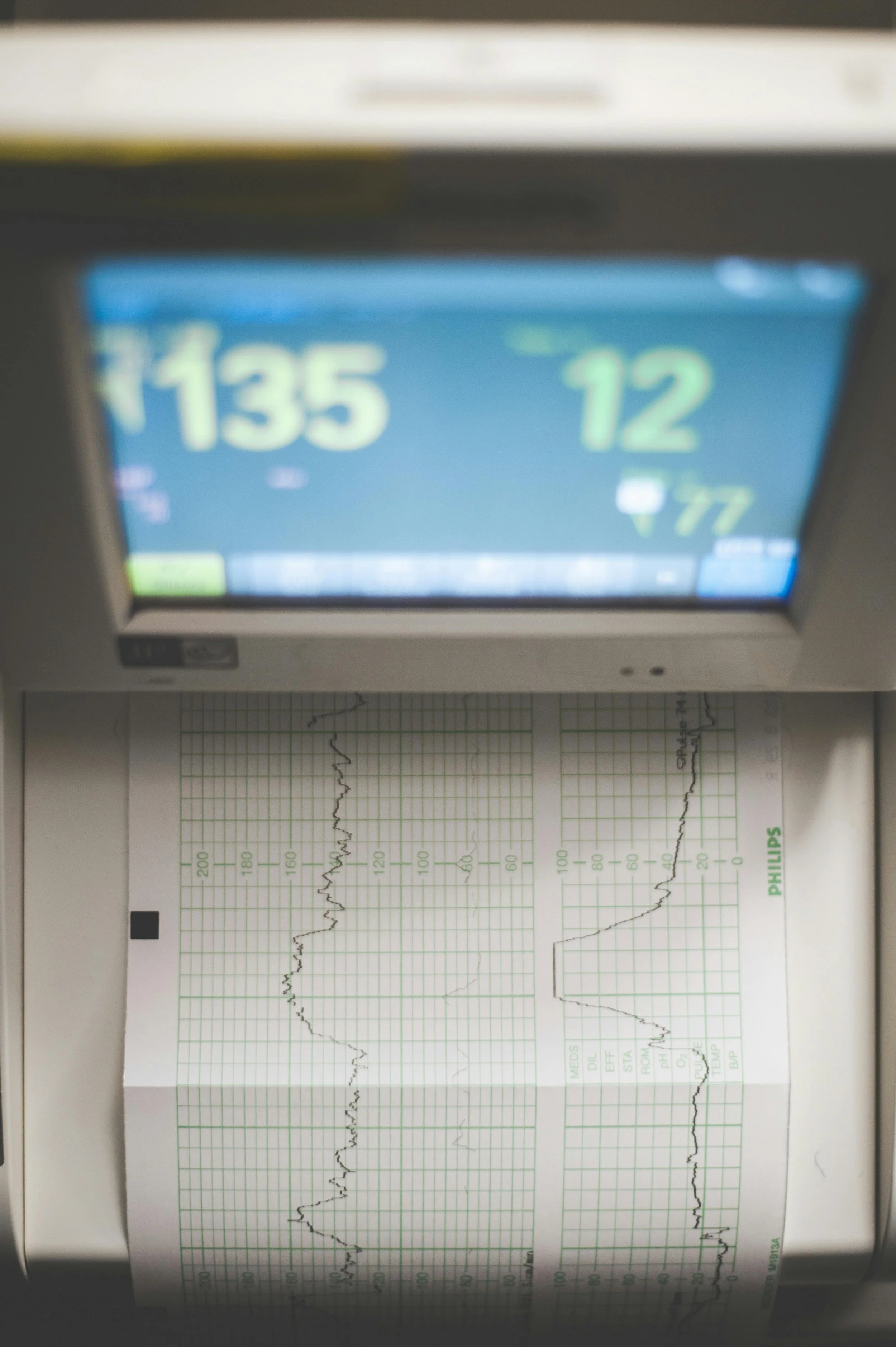 Heart Health Screening London 2026: ECG, Echocardiogram and Cardiac MOT Complete Guide