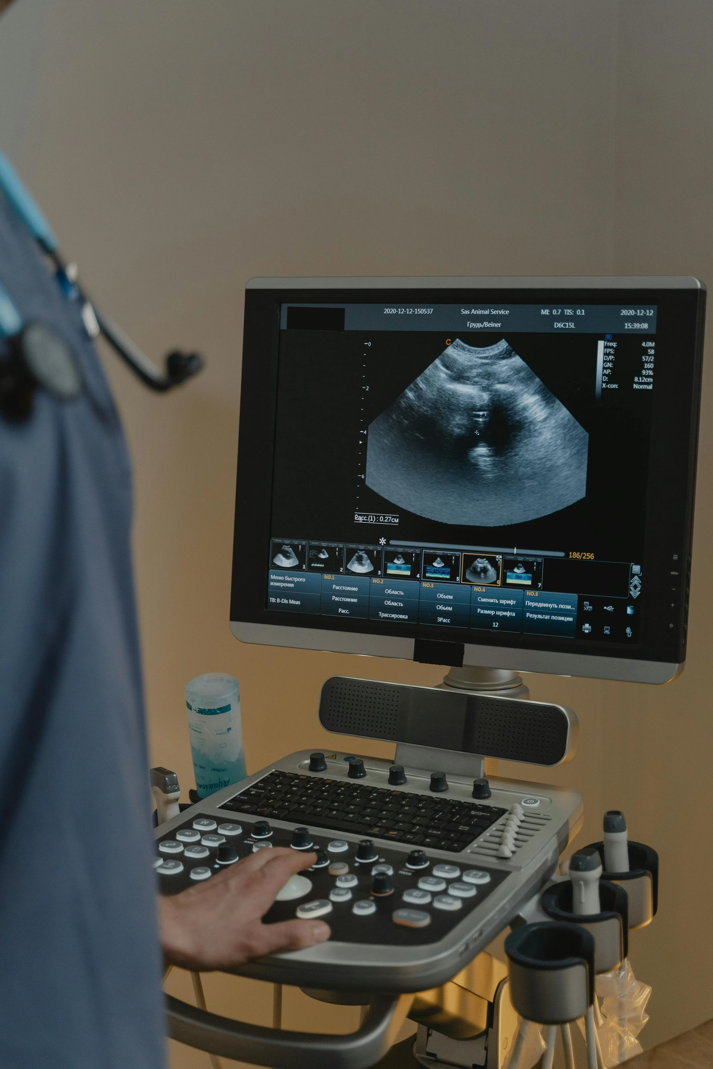 Liver Health Screening London 2026: The Complete Guide to Fatty Liver Scans, Liver Function Tests and Private Liver Assessment
