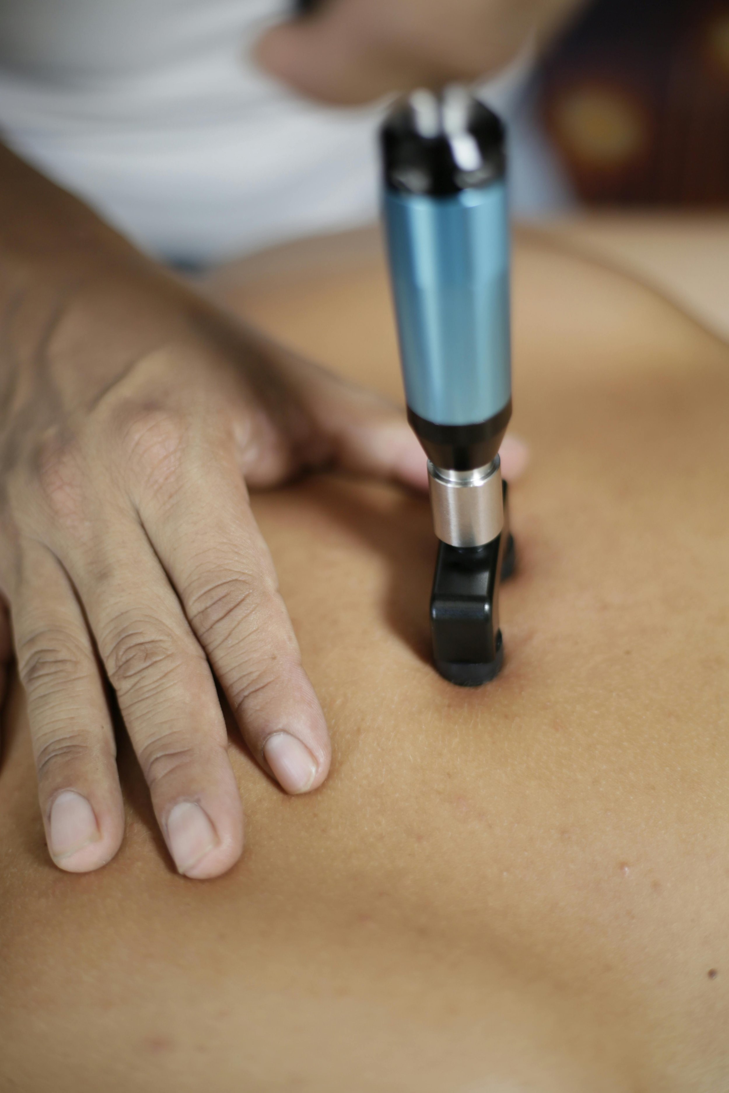 Wart and Verruca Removal London 2026. Doctor-Led Cryotherapy at The Online GP by The Wellness