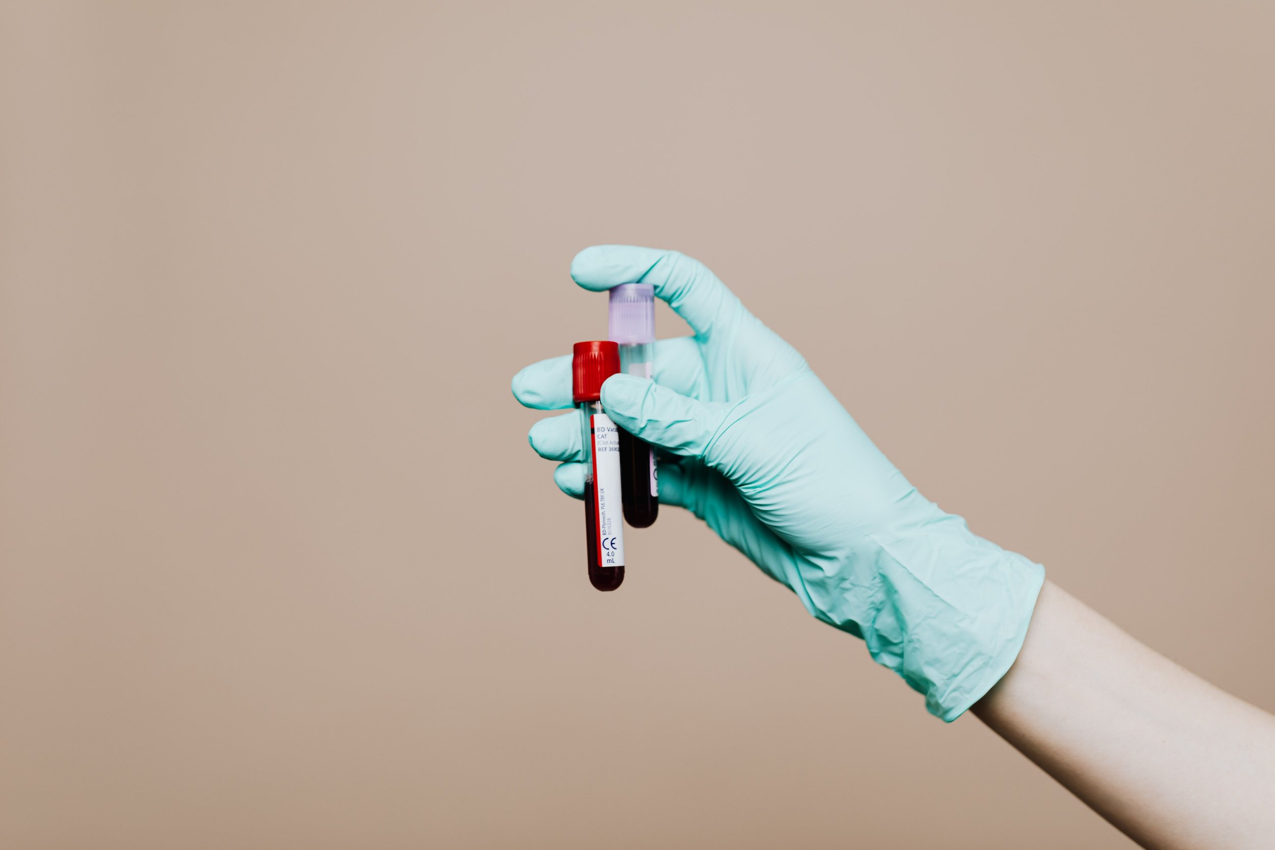 Private Blood Tests in London. What to Test and What Your Results Mean