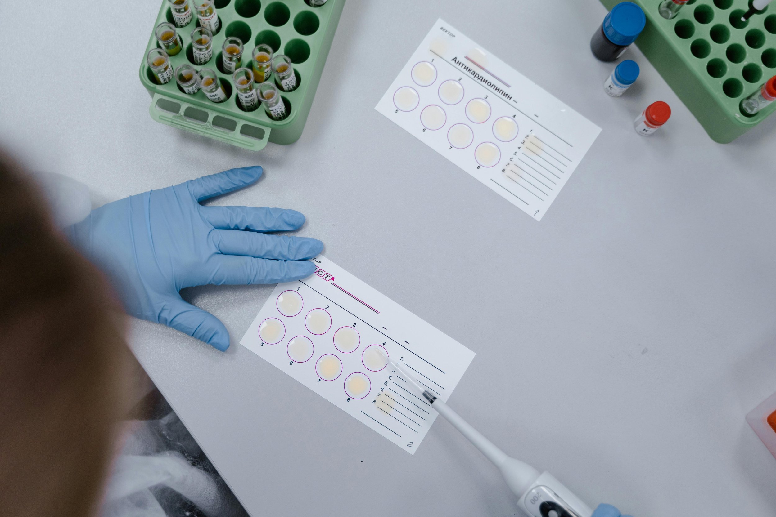 Allergy Testing in London. Find Out What You Are Reacting To