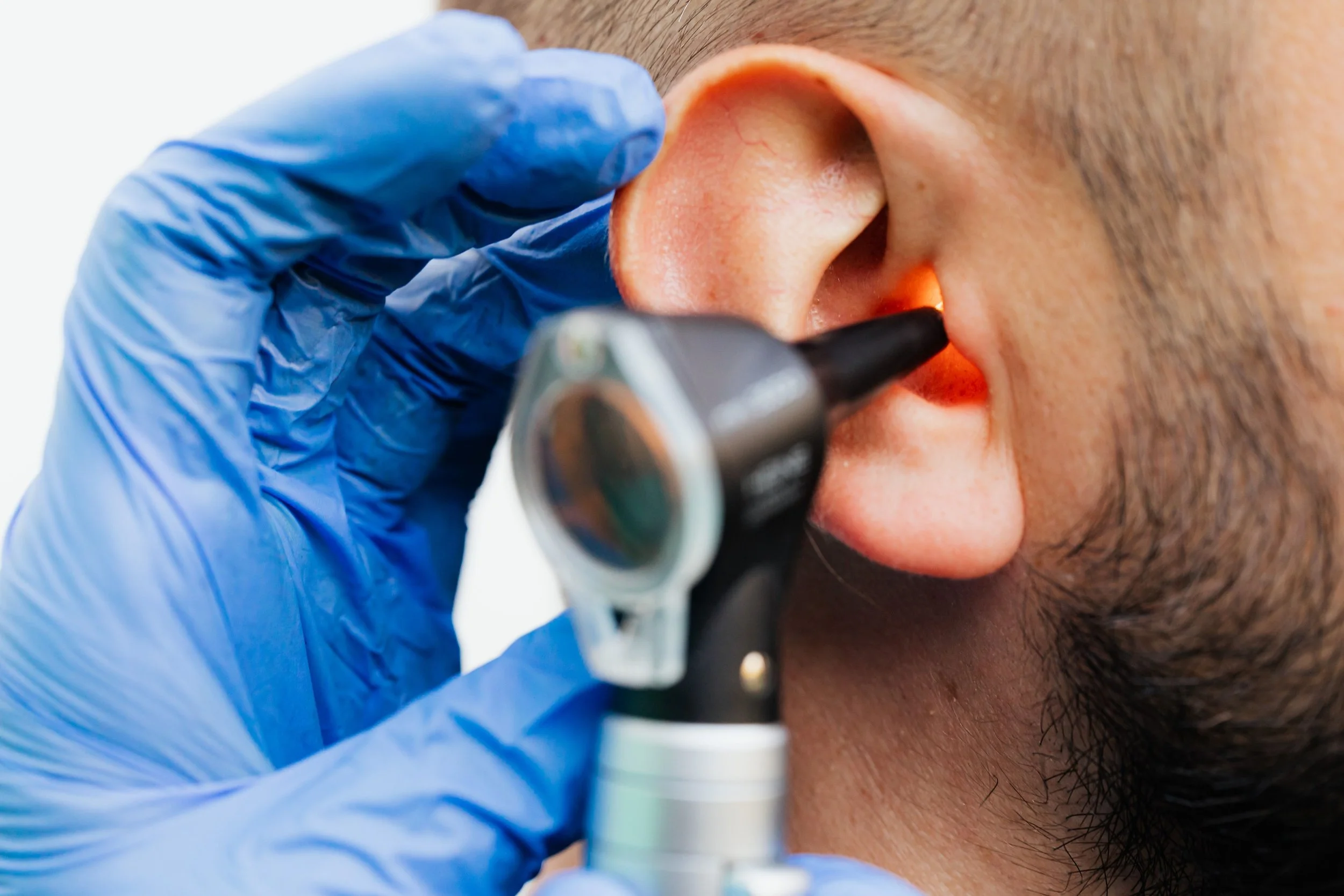 Ear Wax Removal in London. Same Day Microsuction by a Doctor