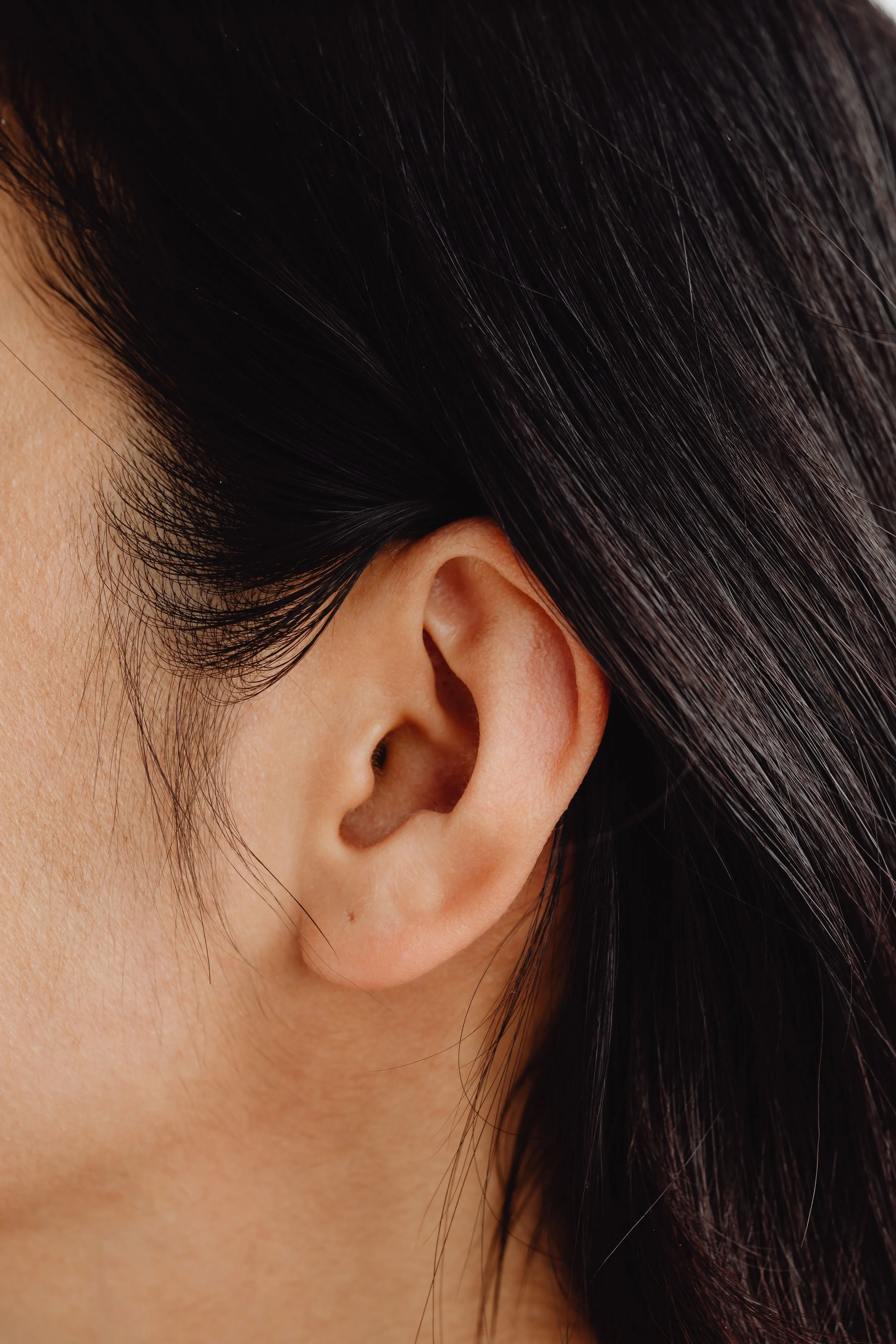 Split Earlobe Repair London 2026. What It Costs, Why Stitching It Alone Fails, and When You Can Wear Earrings Again