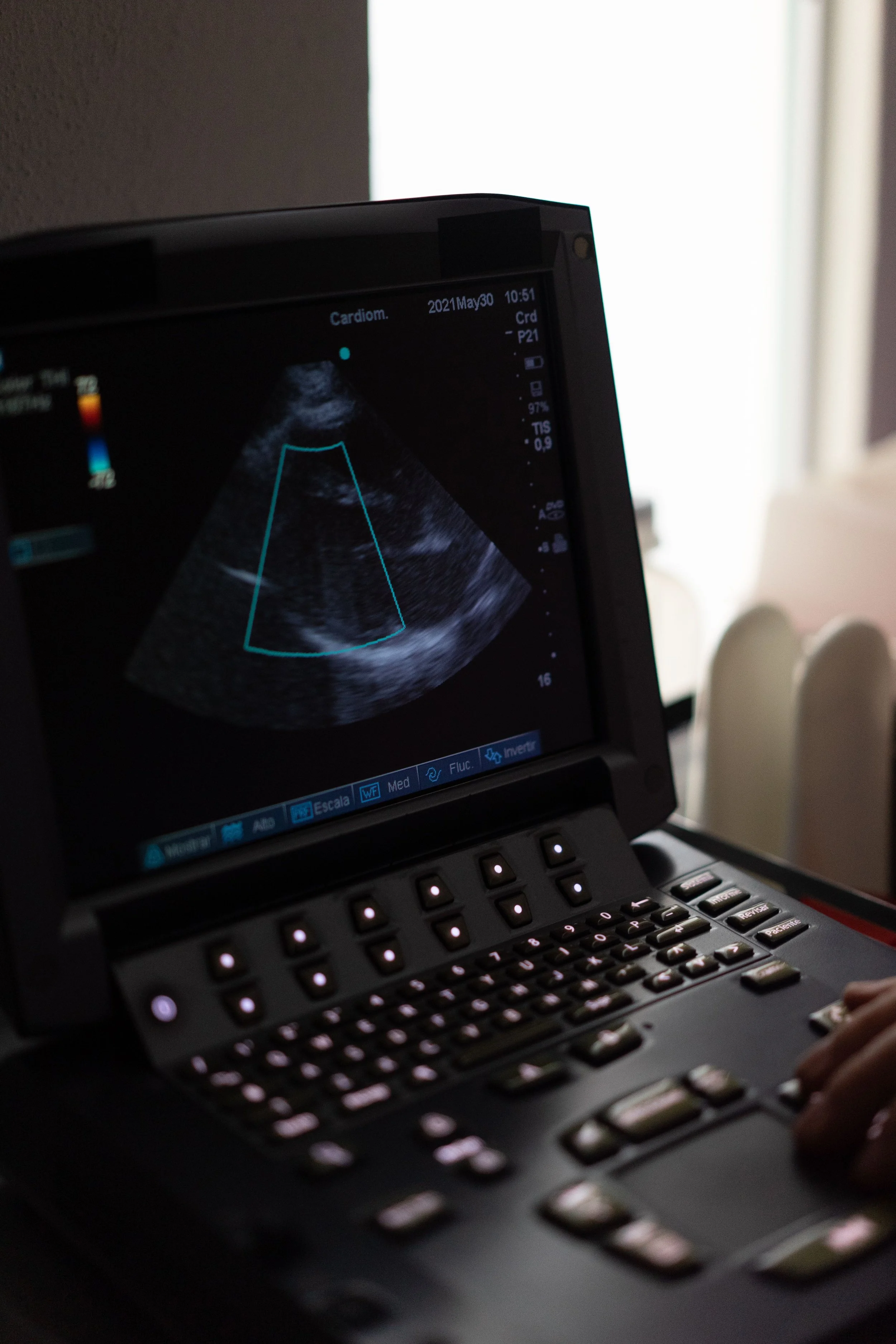 Ultrasound-Guided Injections London 2026. Why Blind Injections Miss, What Guided Treatment Costs, and Why the Scan Should Come First