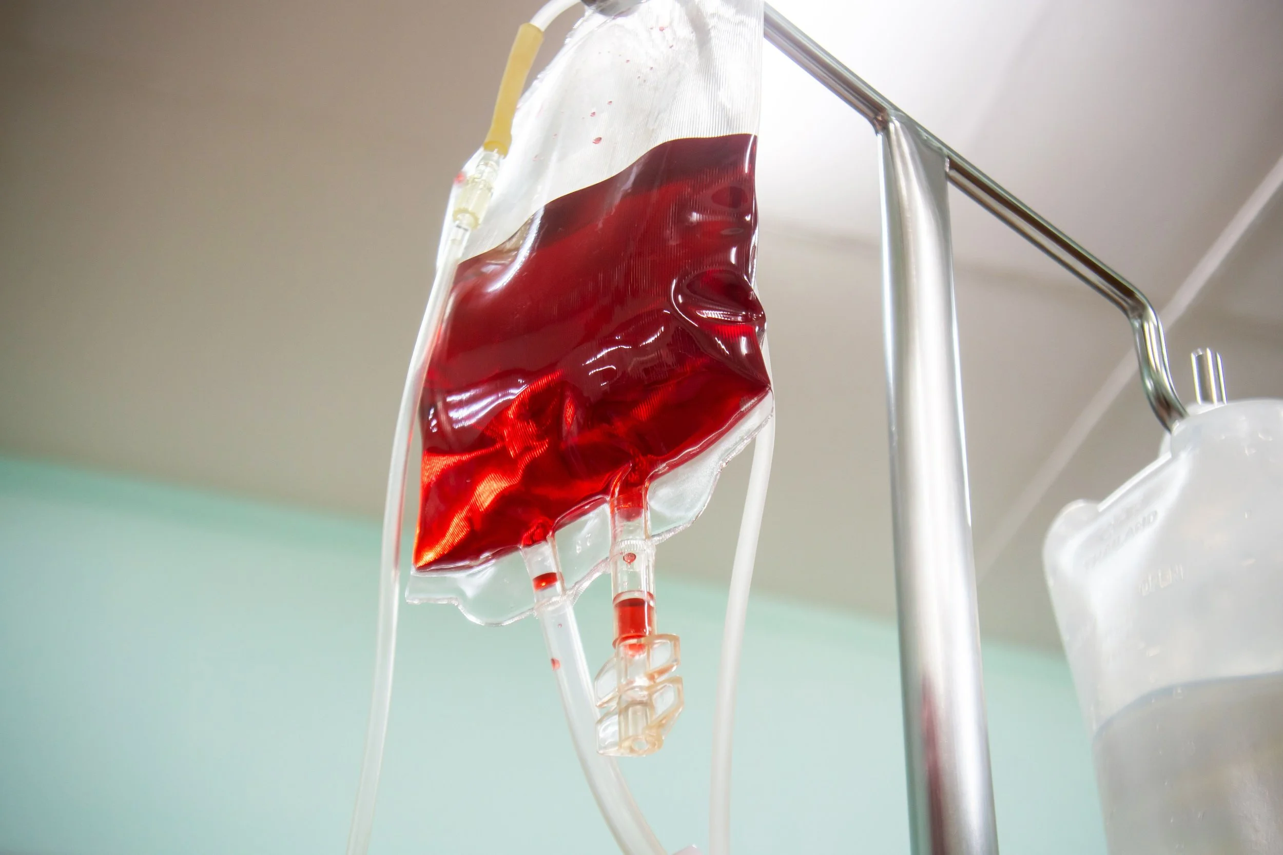Iron Infusion in London 2026. Doctor-Led Diagnosis, One-Hour Treatment and the Cause Found, from The Wellness