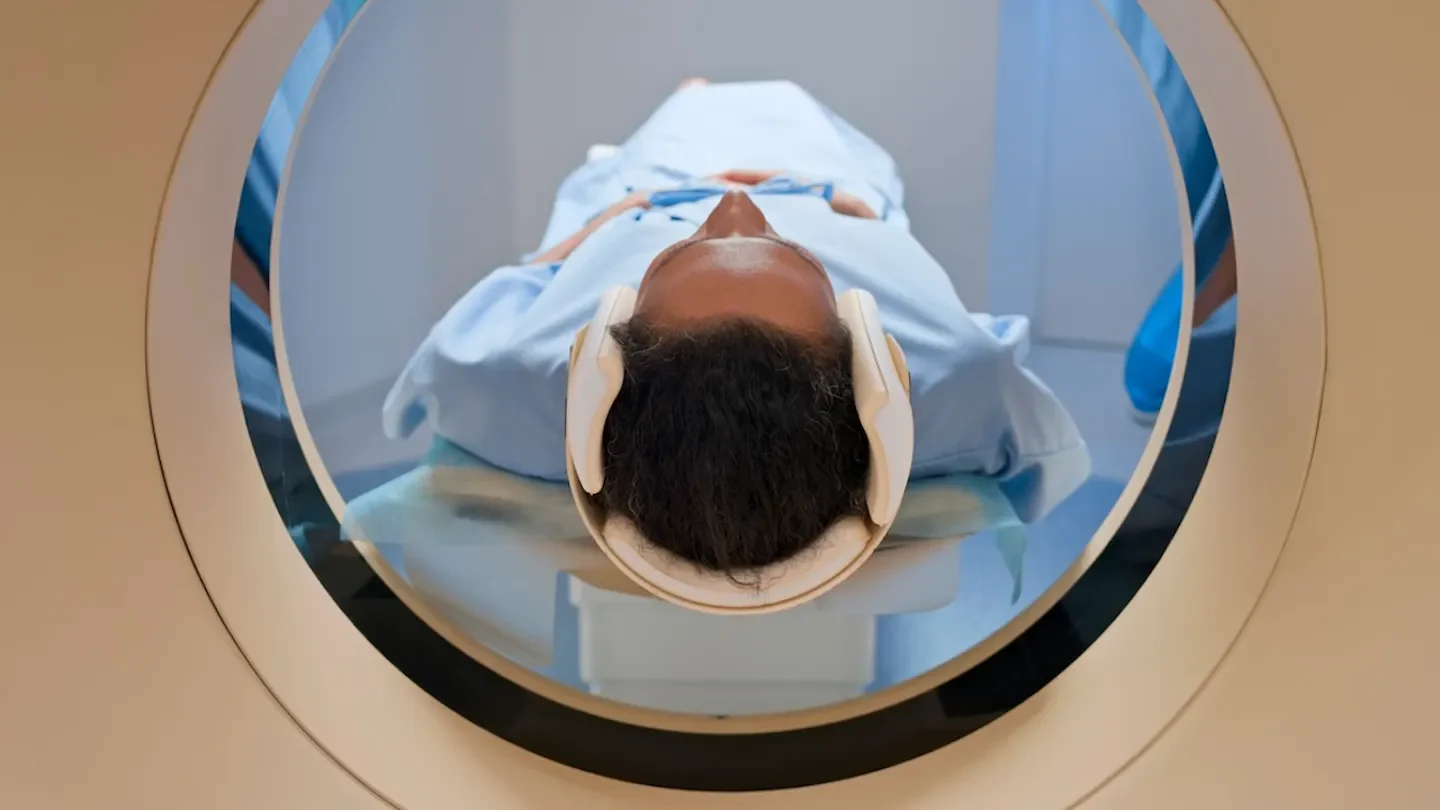 Full-Body and Targeted MRI Screening -When It's Worth It, and What It Costs