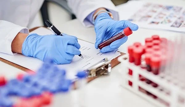 Executive Blood Tests in London 2026. The 100 Marker Assessment, the 4 Results That Change What You Do Next and How Often to Repeat Them