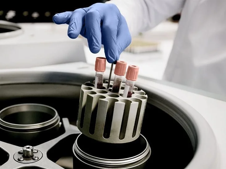Biomarker Screening in London 2026. A Complete Guide to What to Measure, What It Means and What to Do About It