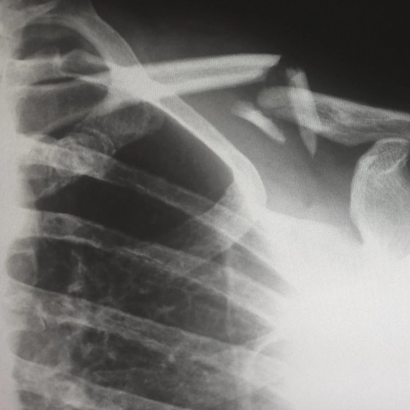 image-treatments-conditions-trauma.png