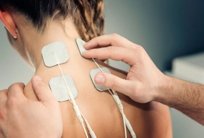 A person receiving an electrical acupuncture treatment with four adhesive pads attached to their neck, connected to wires.