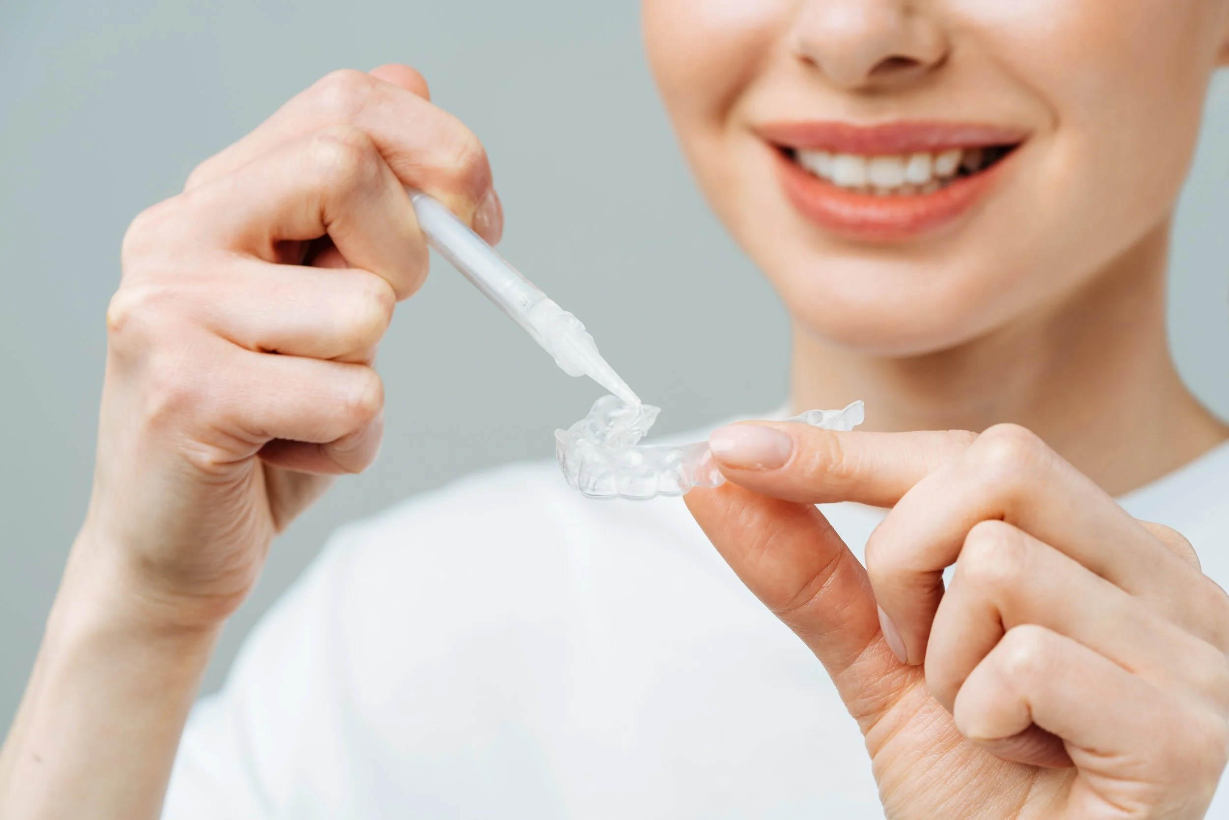 Person smiling and holding a clear dental aligner with one hand while using a syringe to apply adhesive or gel to it with the other hand.