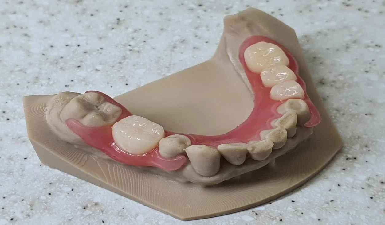 How 3D Printed Flexible Partials Are Transforming Modern Dental Practices