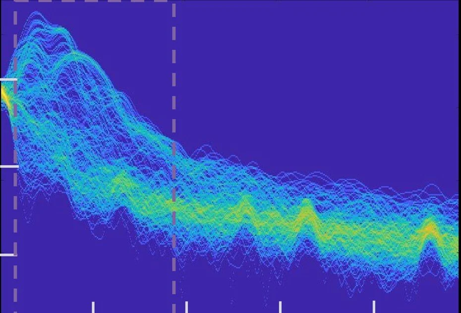 Project lead: Statistical signal processing for advanced diagnostics from wearables