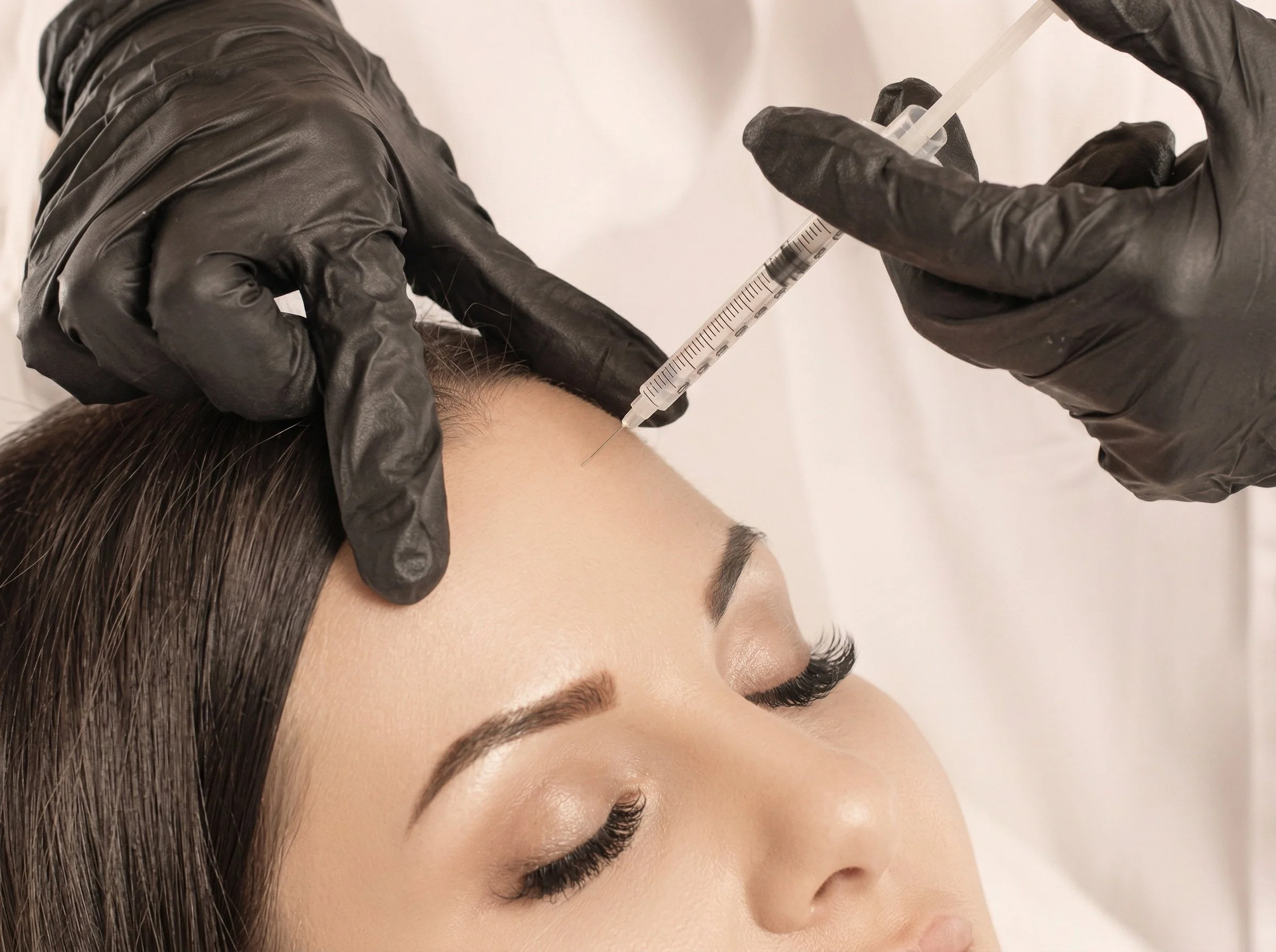 Une femme reçoit une injection faciale, le praticien porte des gants noirs et tient une seringue près de son front.