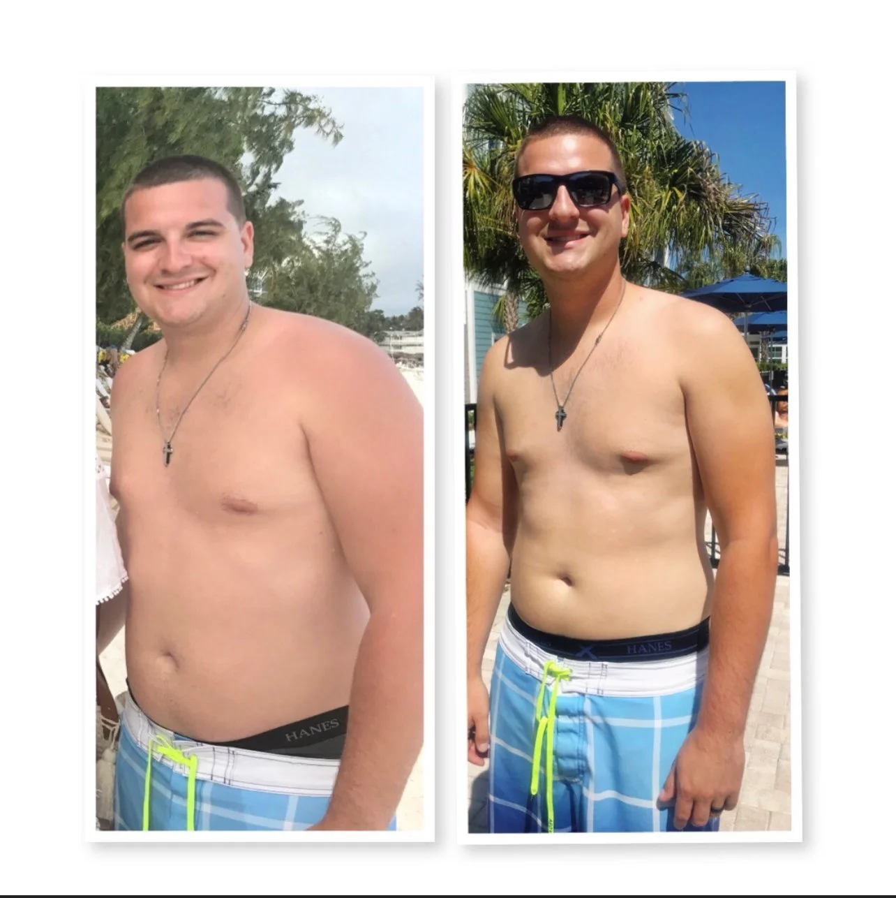 Side-by-side comparison of a young man shirtless at a beach, showing weight loss transformation, wearing blue plaid swim shorts and a cross necklace, with background including trees and blue sky.