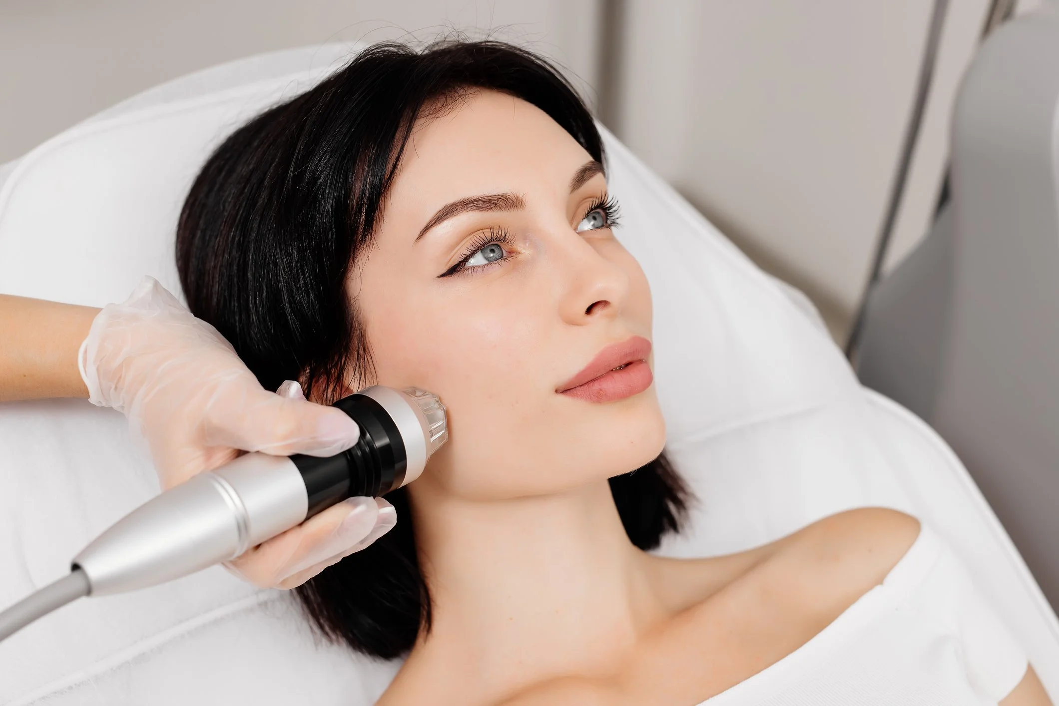 Microneedling