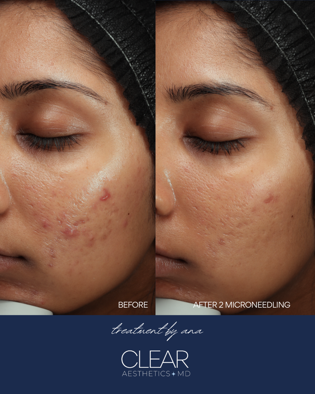 Before and Afters ClearGSS copy.png