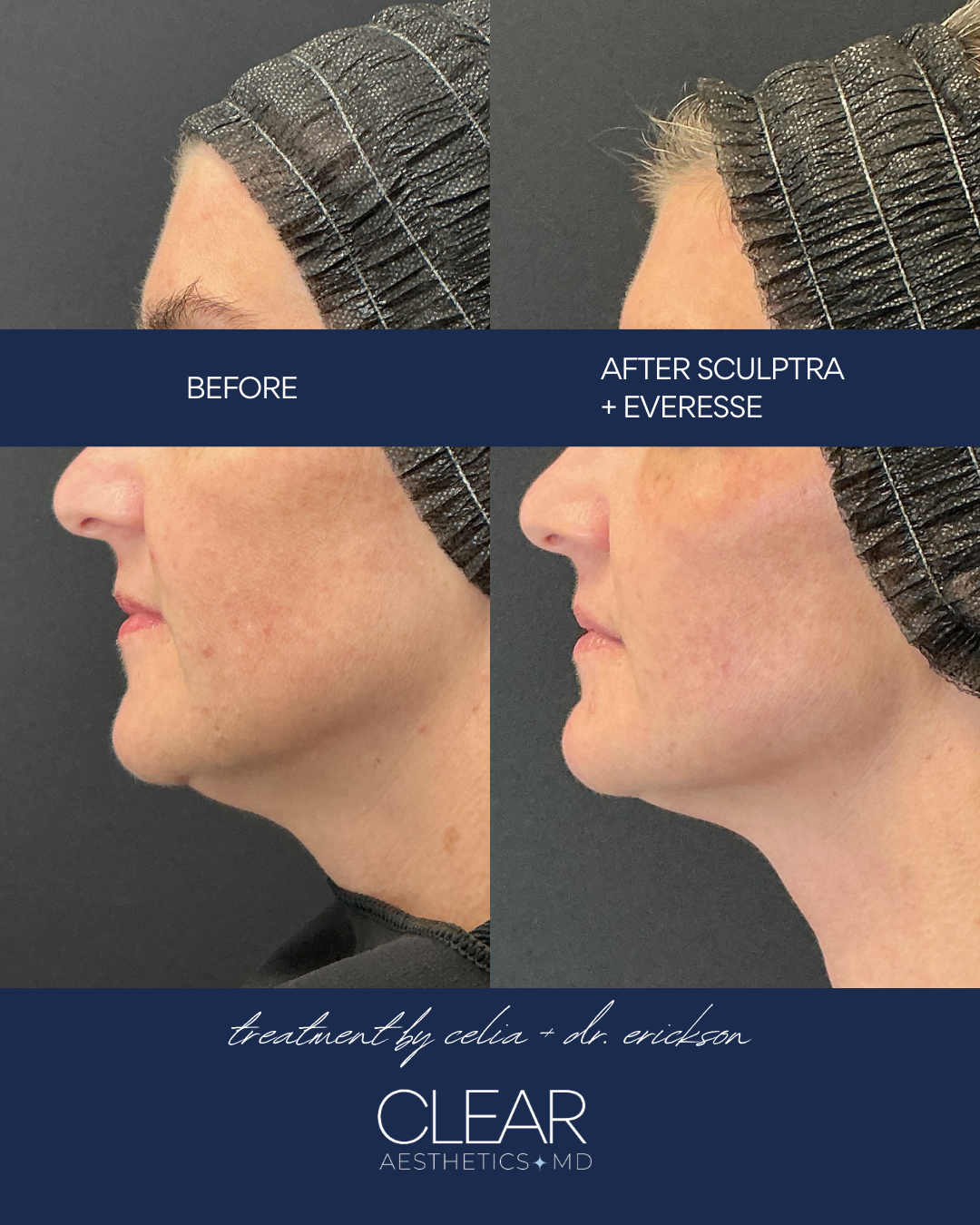 March Social Media (GSSClear) (2).png