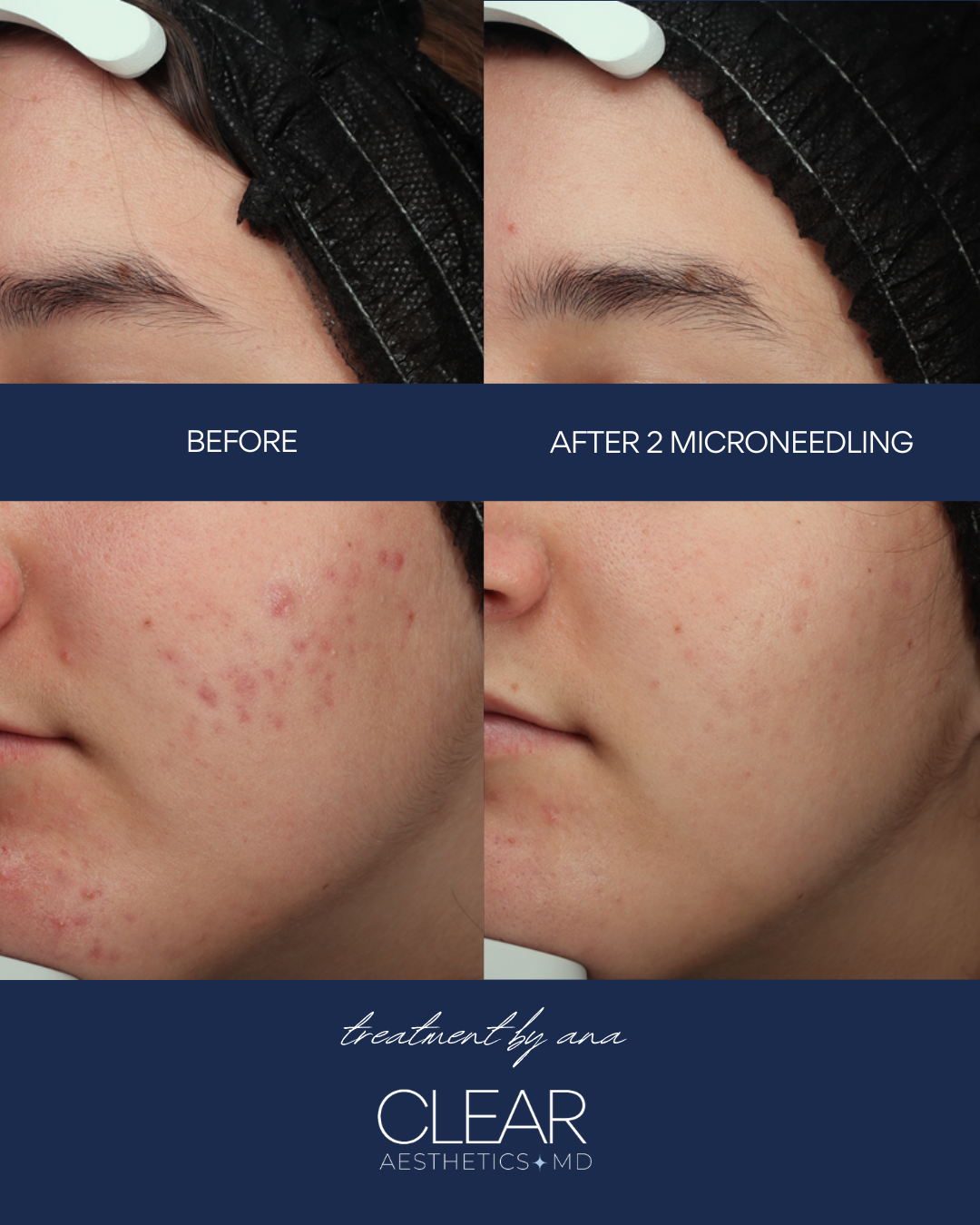 Before and Afters ClearGSS.png