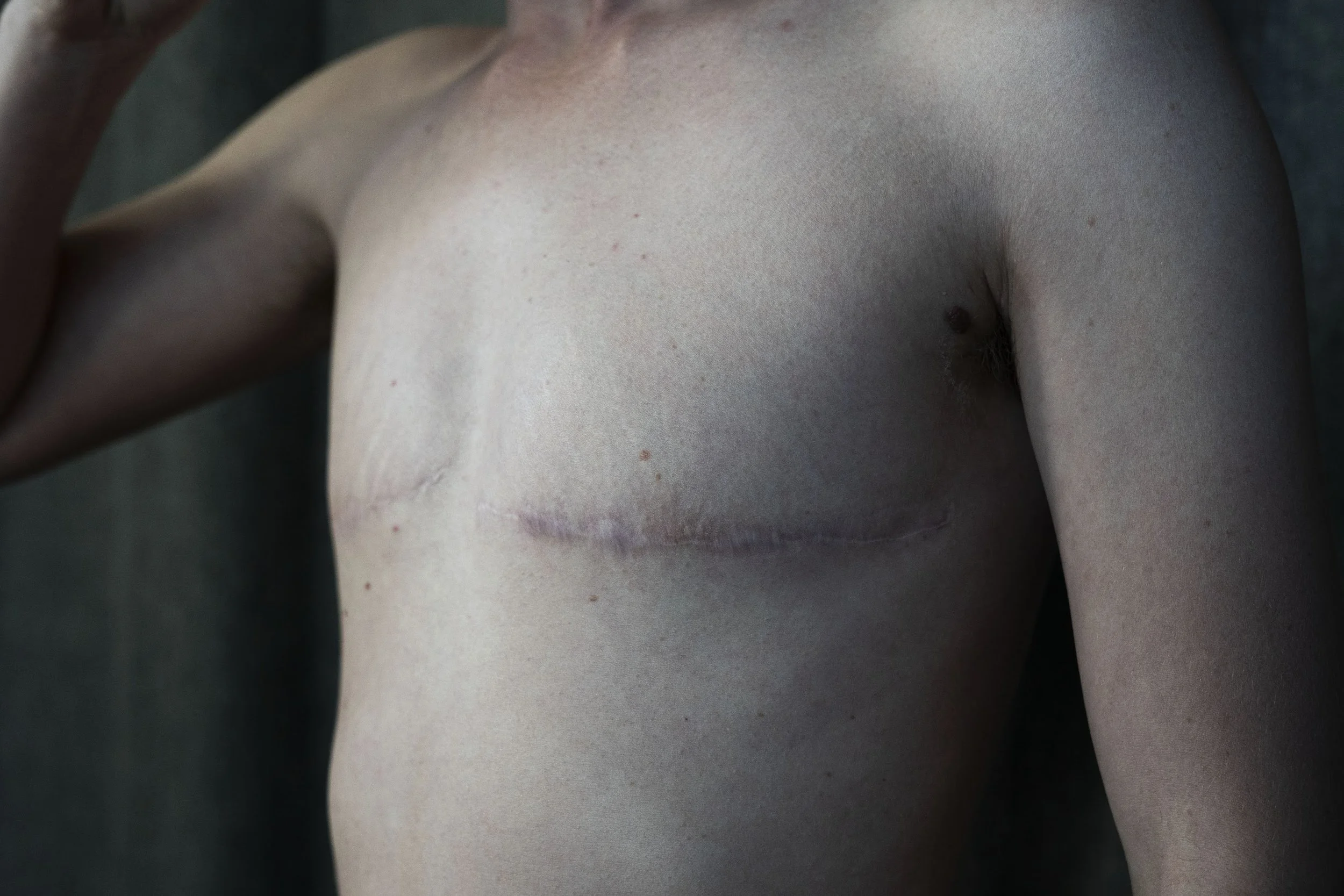 Scar_012 copy.jpg