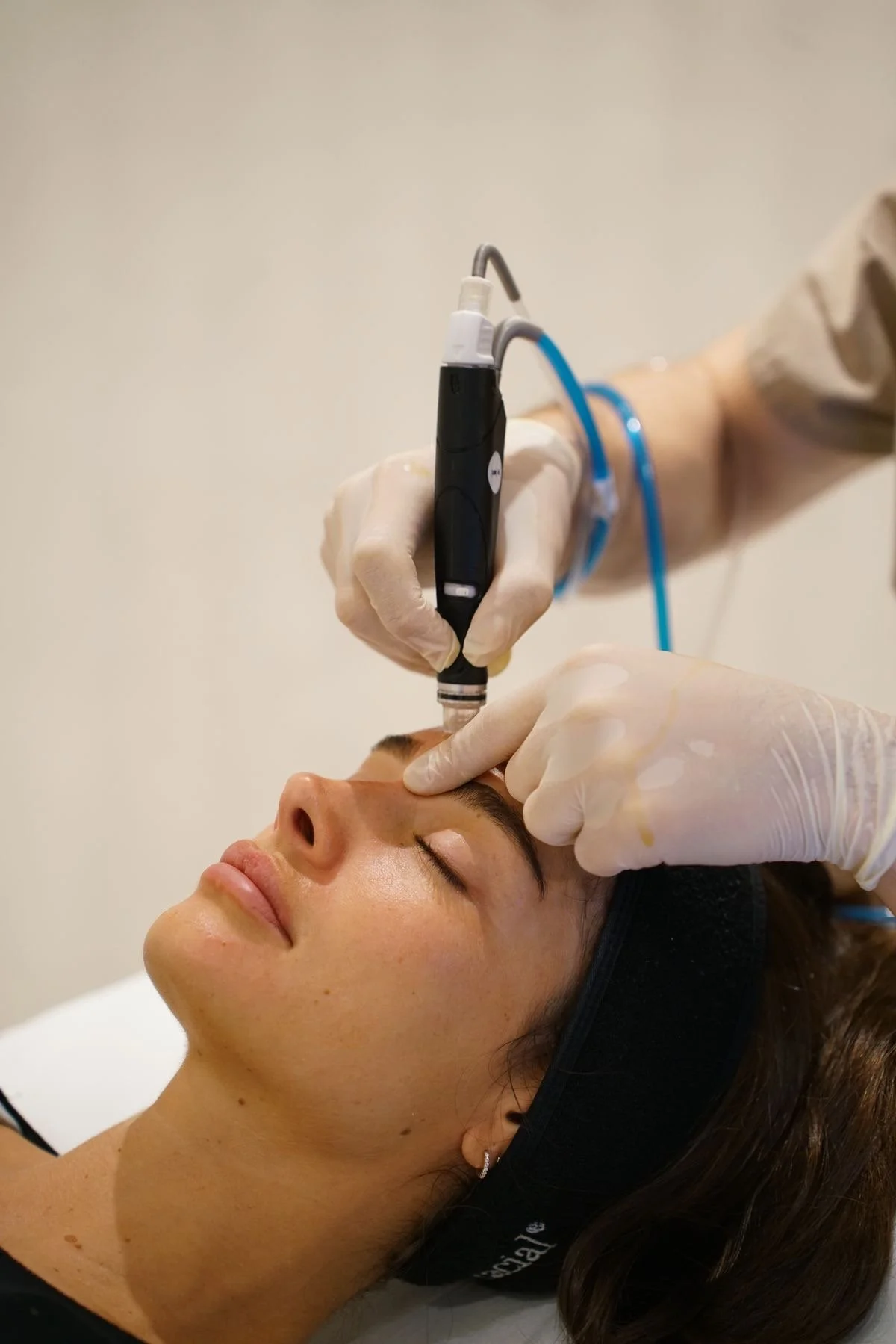 HydraFacial treatment being performed on a patient at Helalat Clinic in Amman