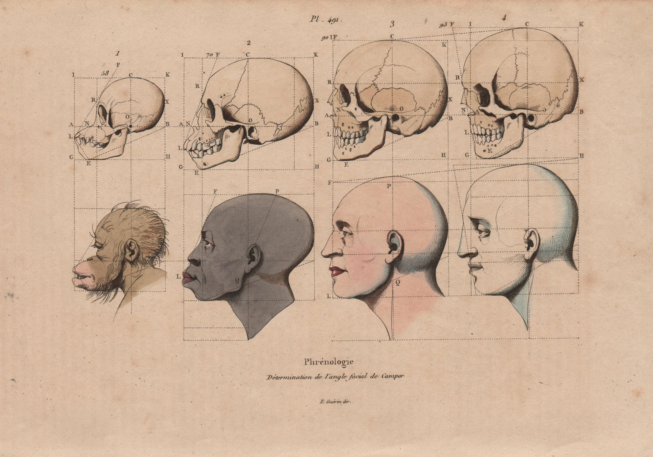 WHAT IS WHITE PRIVILEGE?