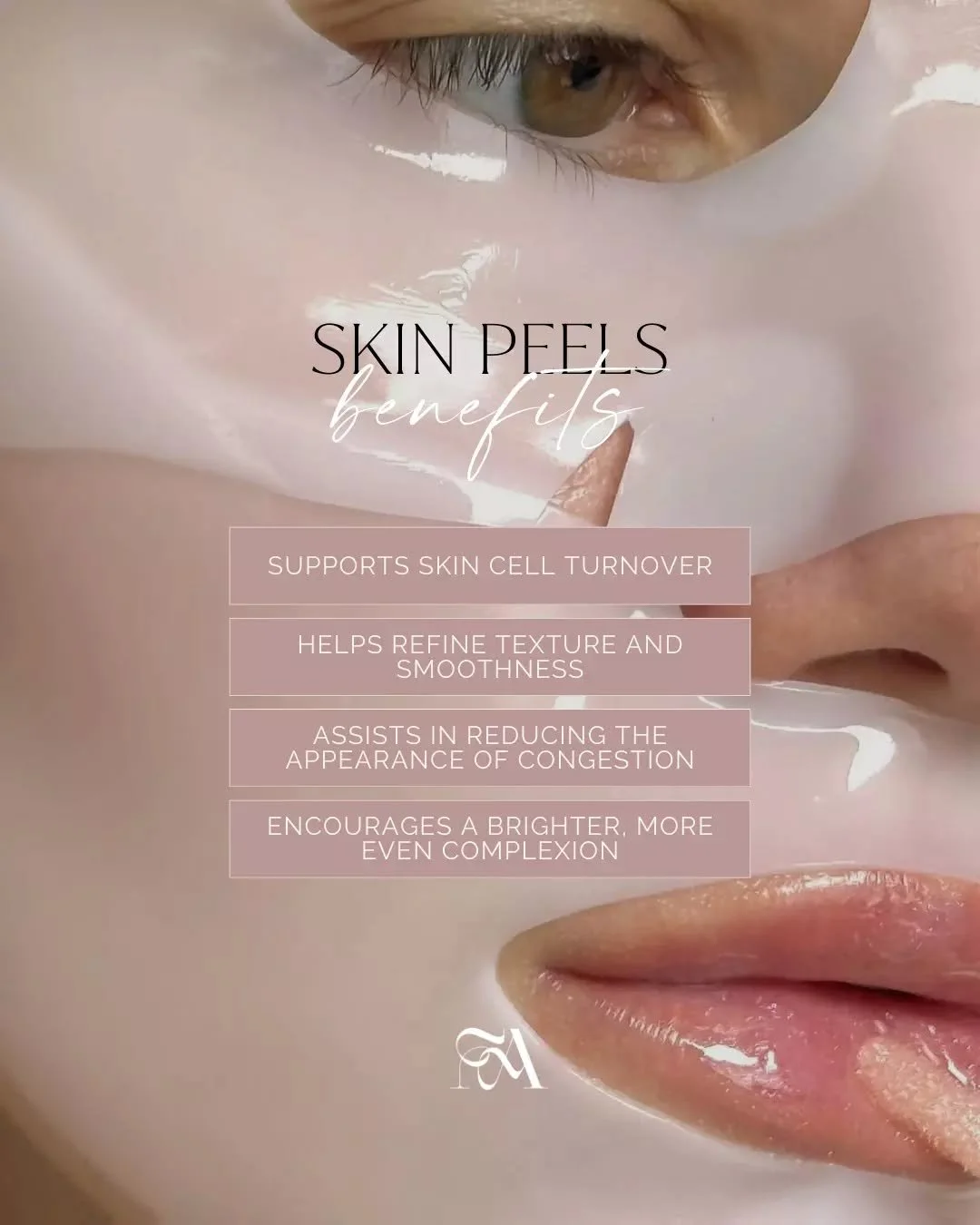 Skin peels can play a role in refining skin texture and encouraging cell turnover.

Consultations at The Fine Art allow us to determine if this approach aligns with your goals.

Every peel is tailored with care, ensuring your skin is supported at eac