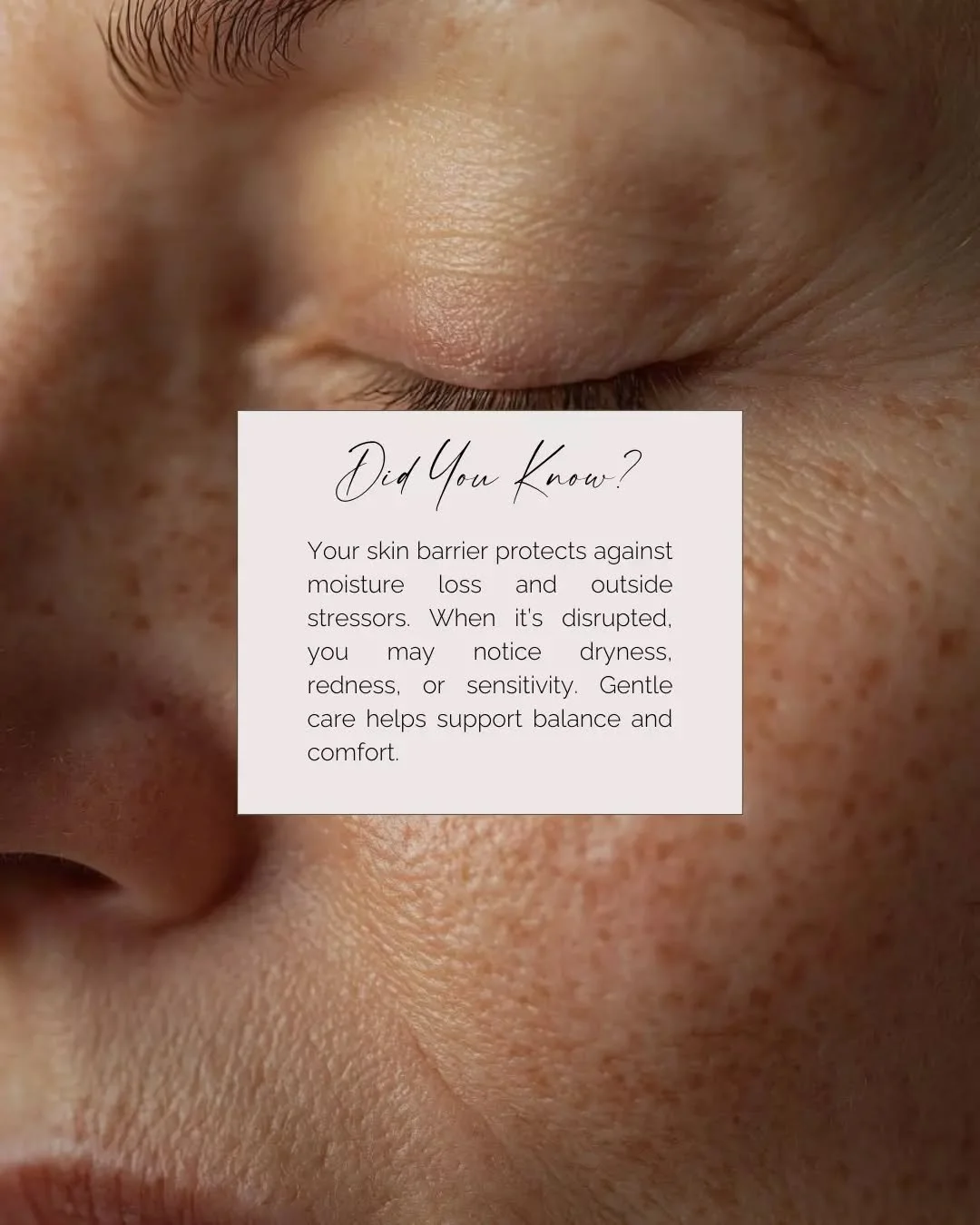 Your skin barrier is your body&rsquo;s natural shield, helping to reduce water loss and protect against external stressors.

When it&rsquo;s compromised, you may experience signs such as dryness, redness, or sensitivity. Supporting your barrier with 