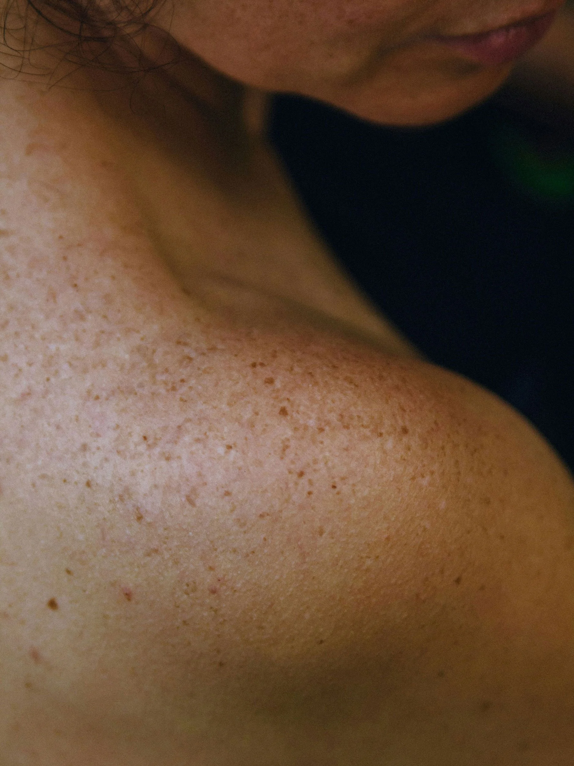 TeslaMed facial treatment using noninvasive aesthetic technology