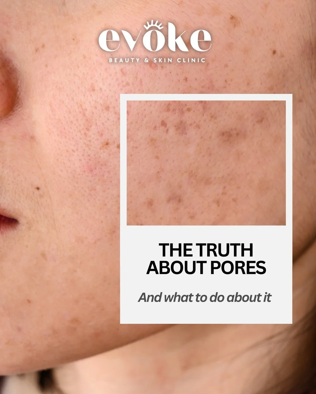 If you&rsquo;ve been fighting your pores, this is your sign to stop.

Most of the time, pores just need the right support, not stronger products. A proper skin analysis can change everything.

Because when your skin is understood, it starts to behave