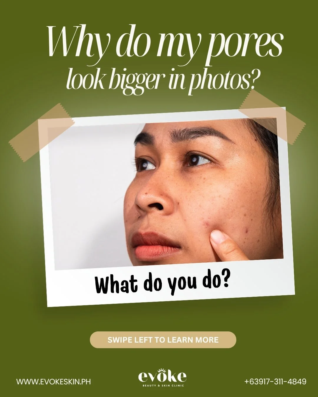 Pores looking bigger in photos? 👀
It&rsquo;s not just your skin.

Swipe &rarr; which one are you guilty of? 😅

Feeling textured or oily?
DM us &ldquo;PORES&rdquo; for your skin reset 💌