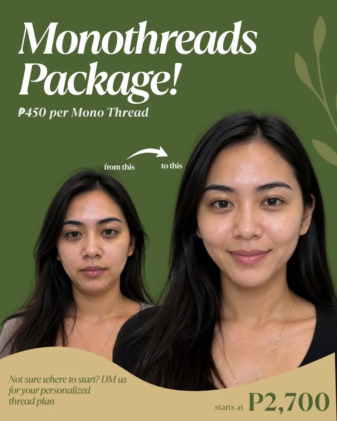A little lift can change the whole vibe. 

Our Monothreads Promo helps soften lines, support collagen, and bring back a firmer, more refreshed look, subtle, natural, still you.

Promo Rate: ₱450 per mono thread
Packages start at ₱2,700

DM us and let