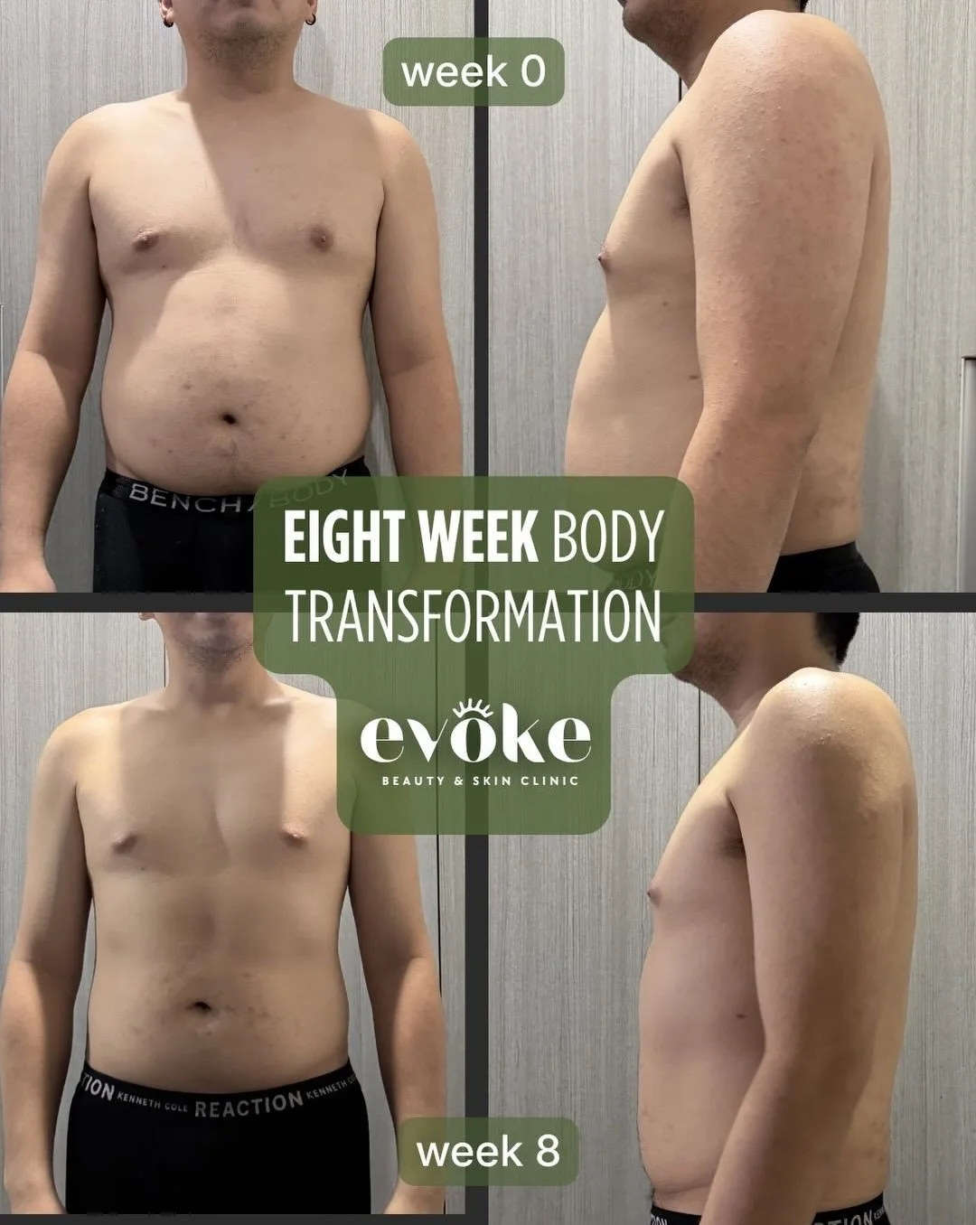 Curious about doctor-supervised weight management? 👀

Our 8-week kickstart pairs medical supervision with real coaching. A licensed doctor screens and monitors you, and we help you build habits that actually last. Appetite support, better routines, 