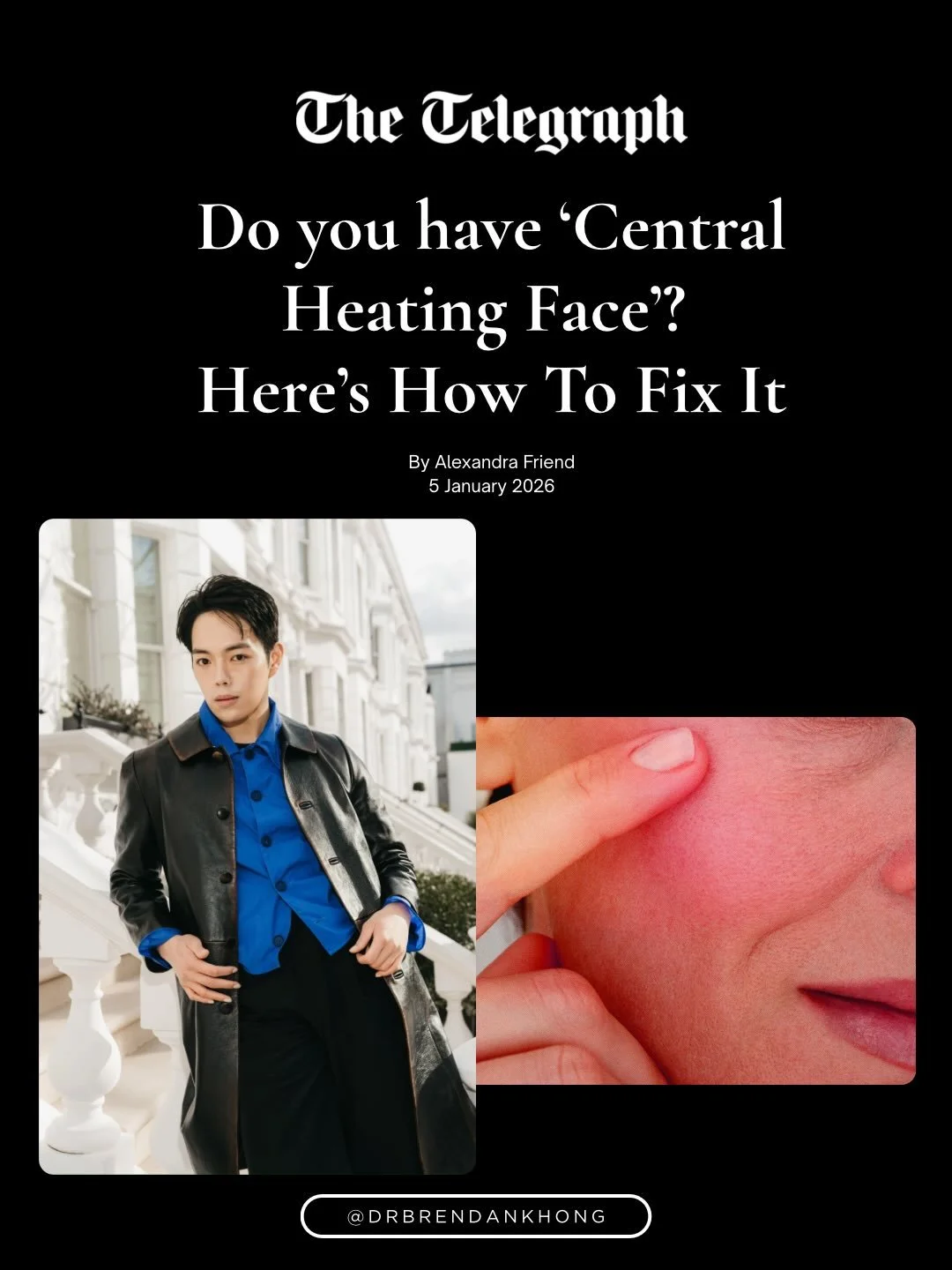 Honoured to be featured in @telegraph discussing all things wind-chill face and skin barrier health during the colder months.
Big thank you to @alexfriendwritesbeauty for the feature, always a pleasure to share practical, skin-first advice🤍

#glasss